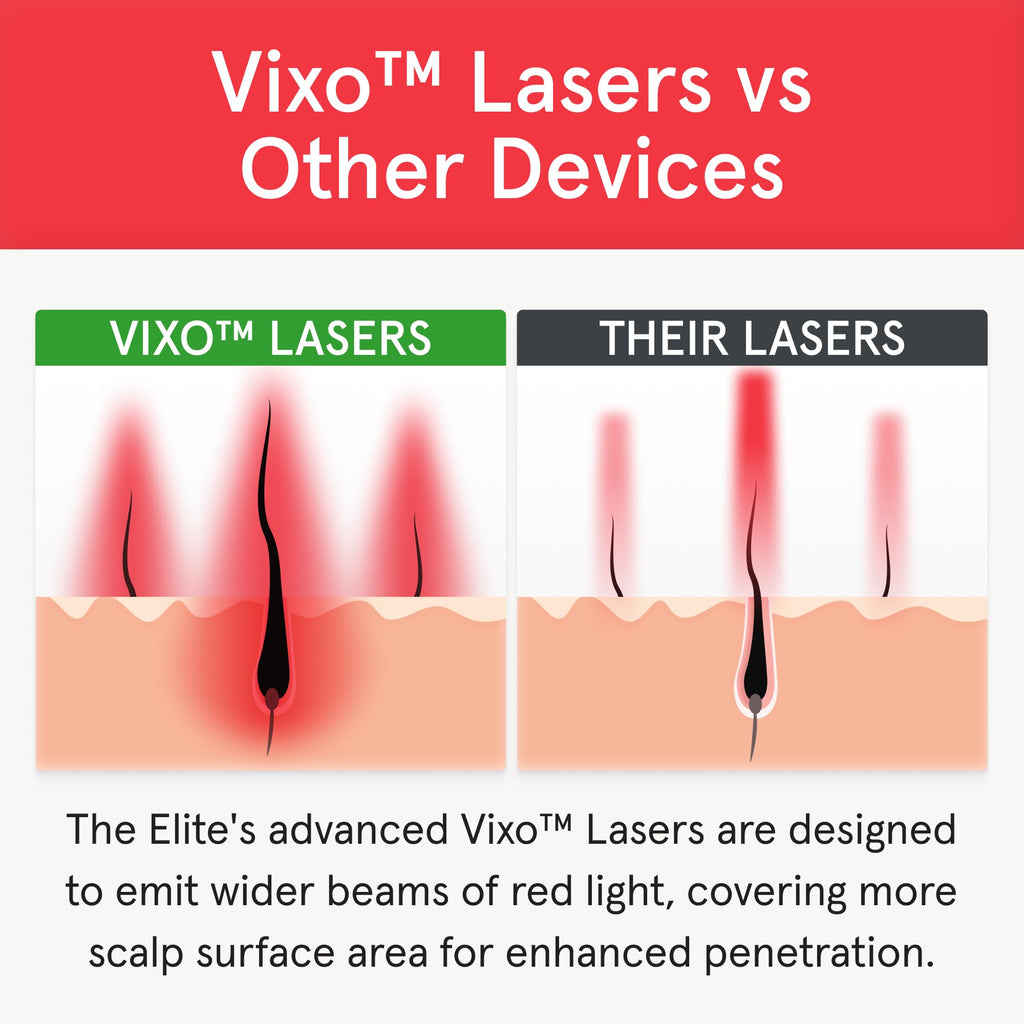 iRestore Elite Laser Hair Growth System – FDA-Cleared Home Treatment with 500 Lasers & LEDs