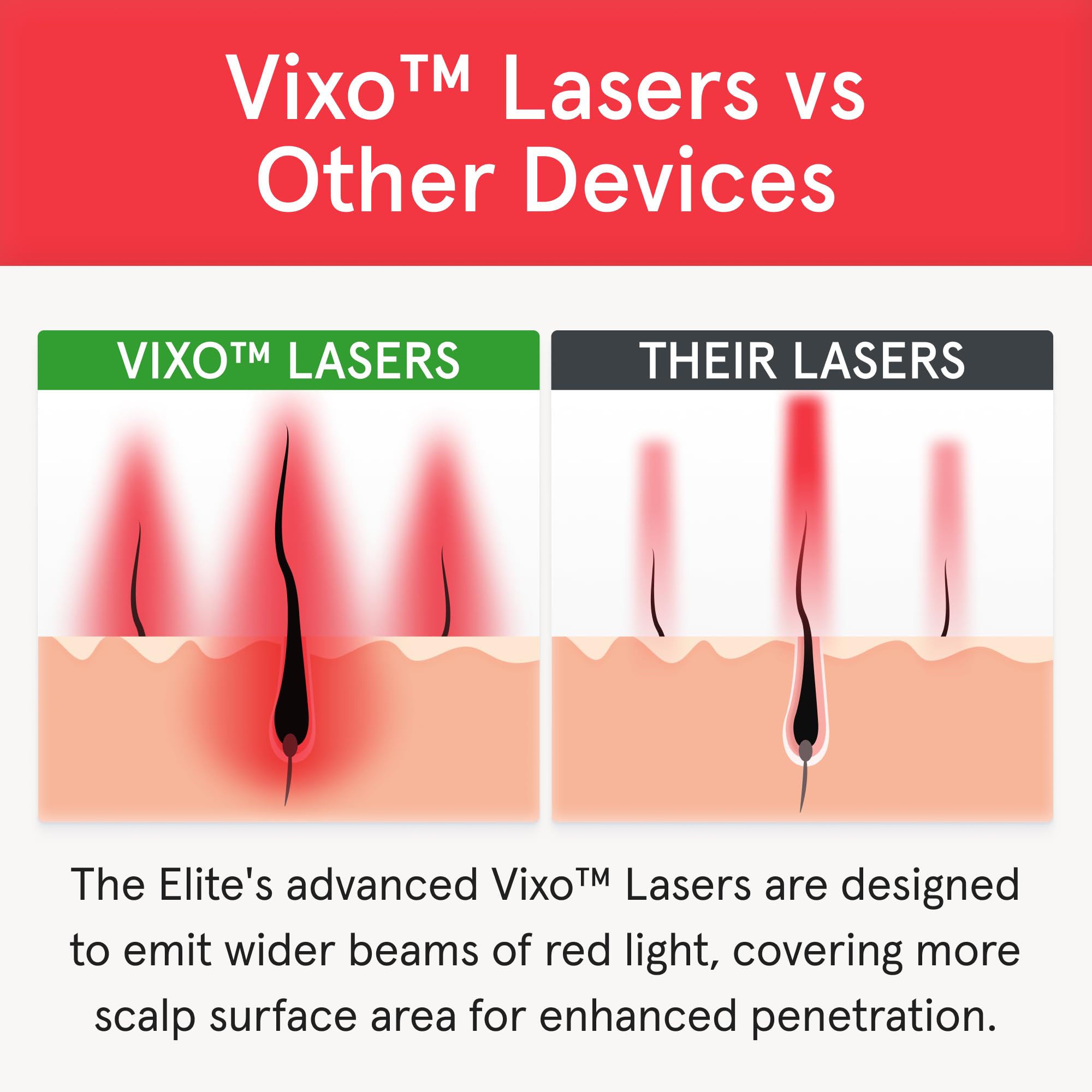 iRestore Elite Laser Hair Growth System – FDA-Cleared Home Treatment with 500 Lasers & LEDs