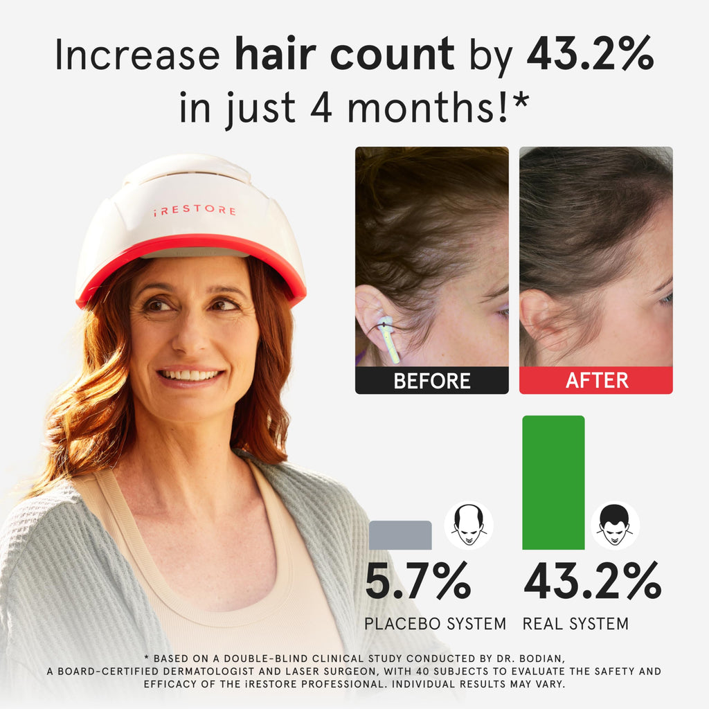 iRestore Pro: 282 Lasers & LEDs Hair Growth System | FDA Cleared