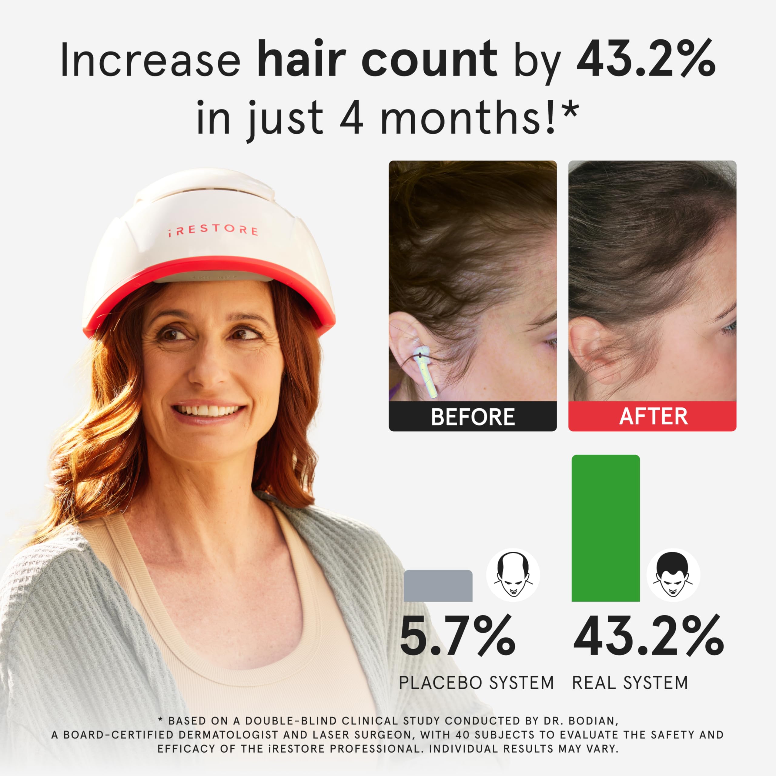 iRestore Pro: 282 Lasers & LEDs Hair Growth System | FDA Cleared
