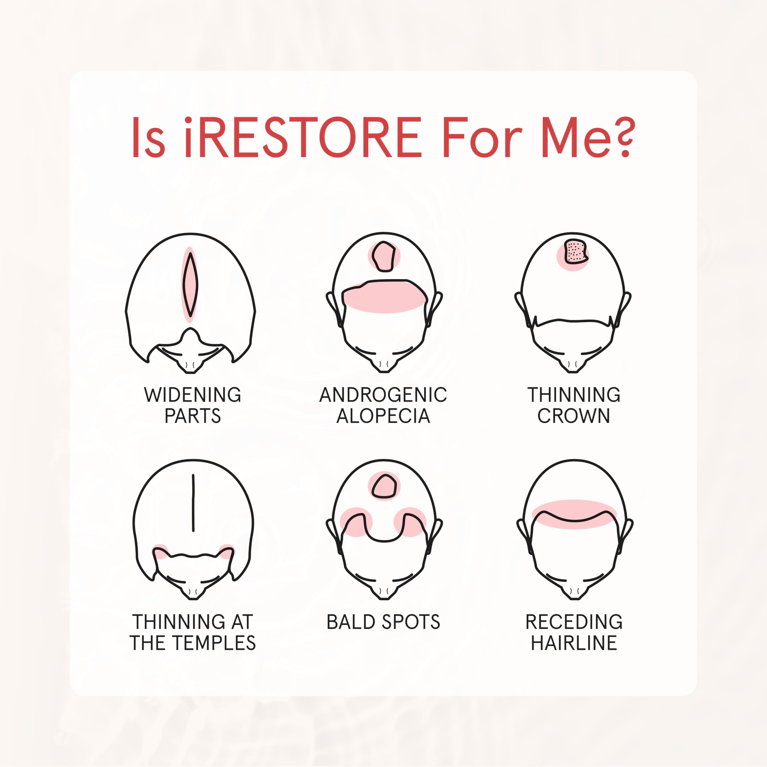 iRestore Anti Hair Loss Shampoo with Biotin – Growth, Thickening & Volumizing for Men & Women