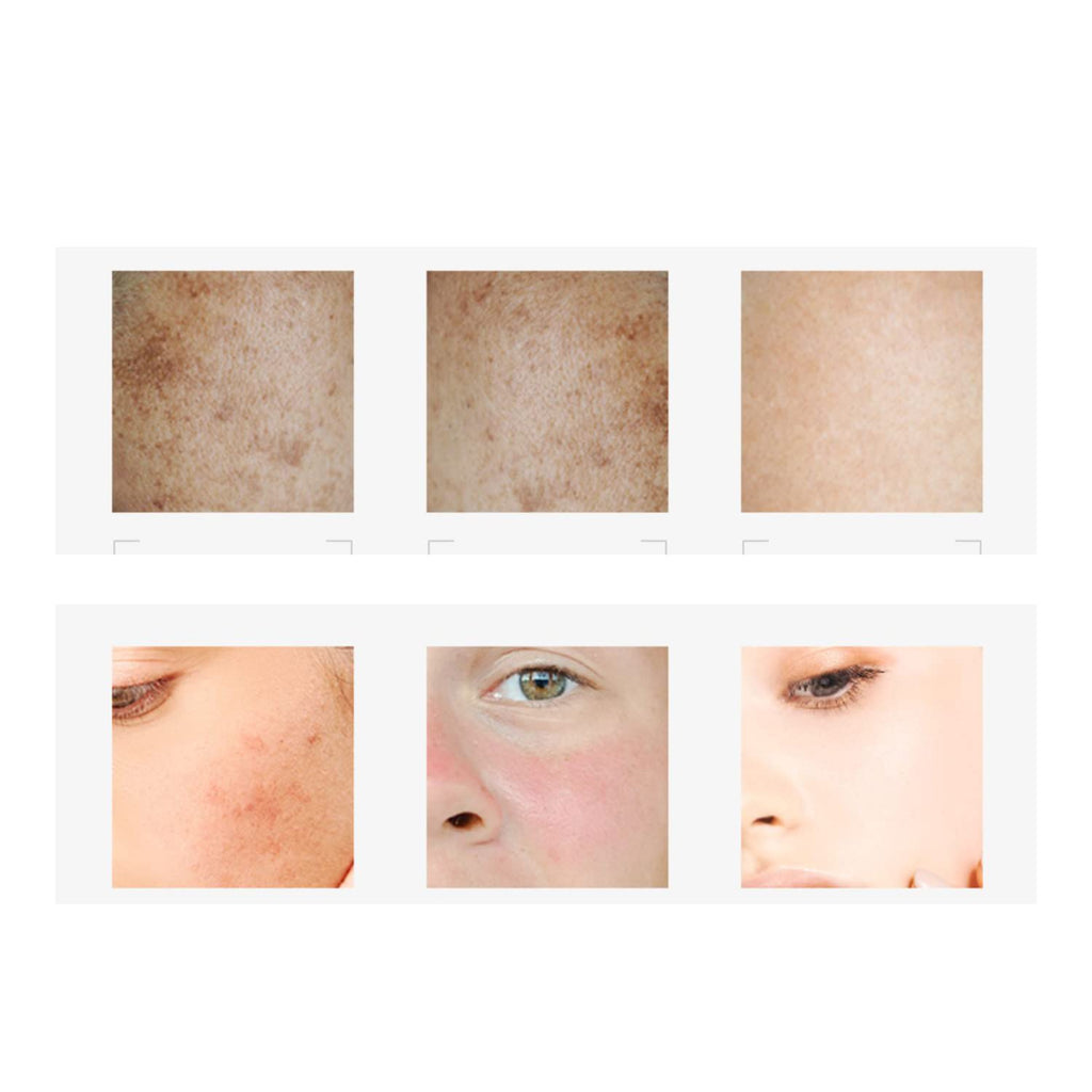 Isana Pigment Spots 2-in-1 Vitamin C Serum | Brighten Freckles & Even Skin Tone, 50ml