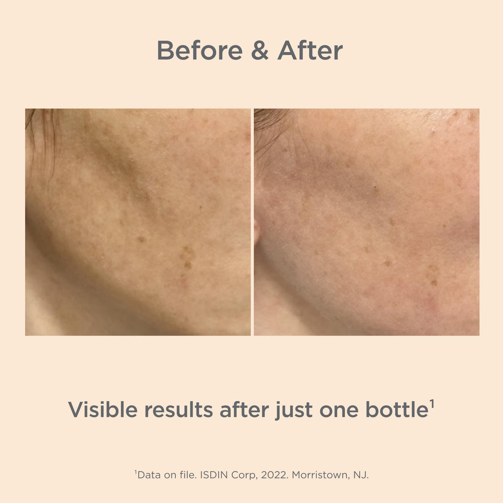 ISDIN Melaclear Advanced Dark Spot Corrector with Niacinamide – 1.7 fl oz
