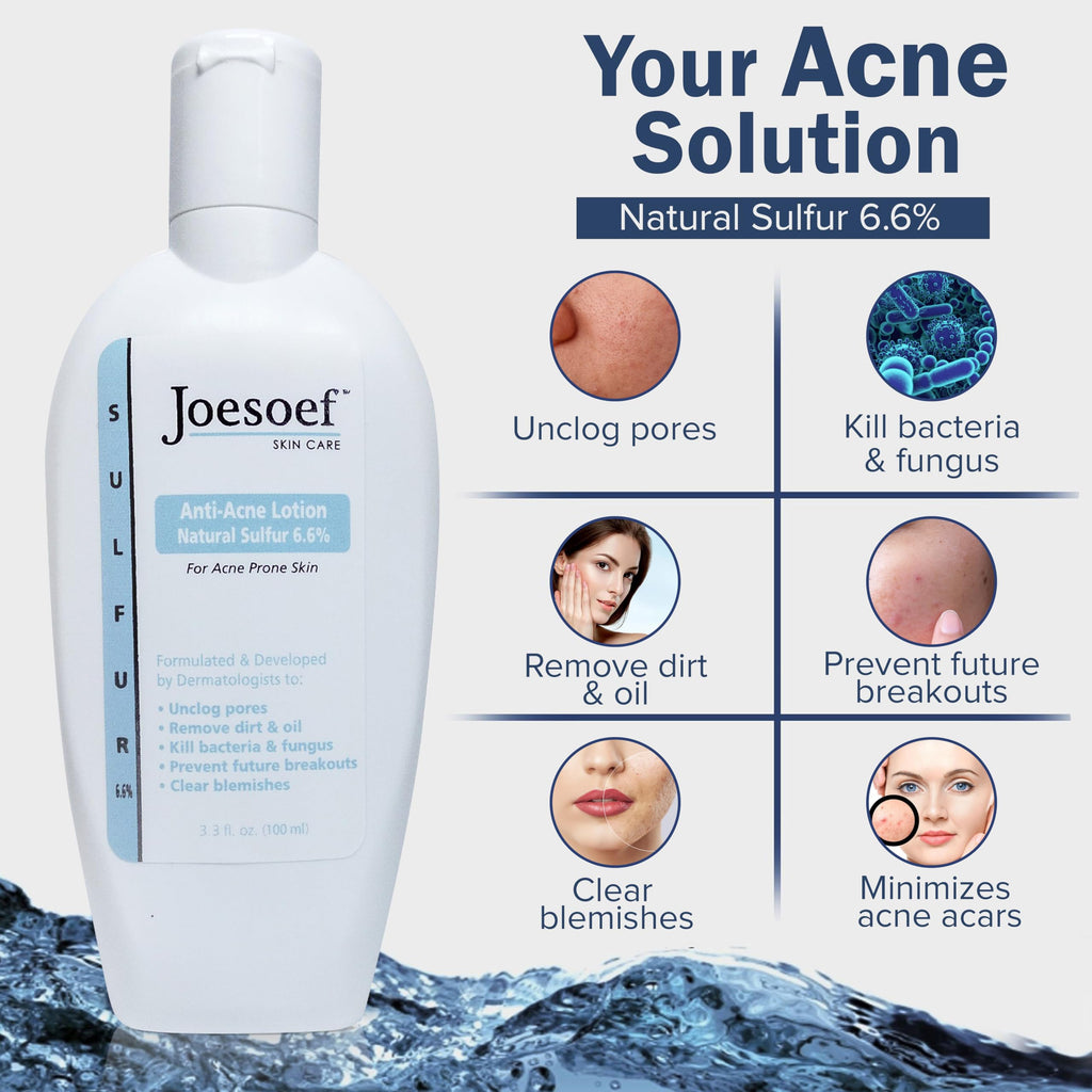 JOESOEF SKIN CARE Anti-Acne Lotion 6.6% Sulfur – Dermatologist-Approved Acne Care for Prone Skin | 100ML