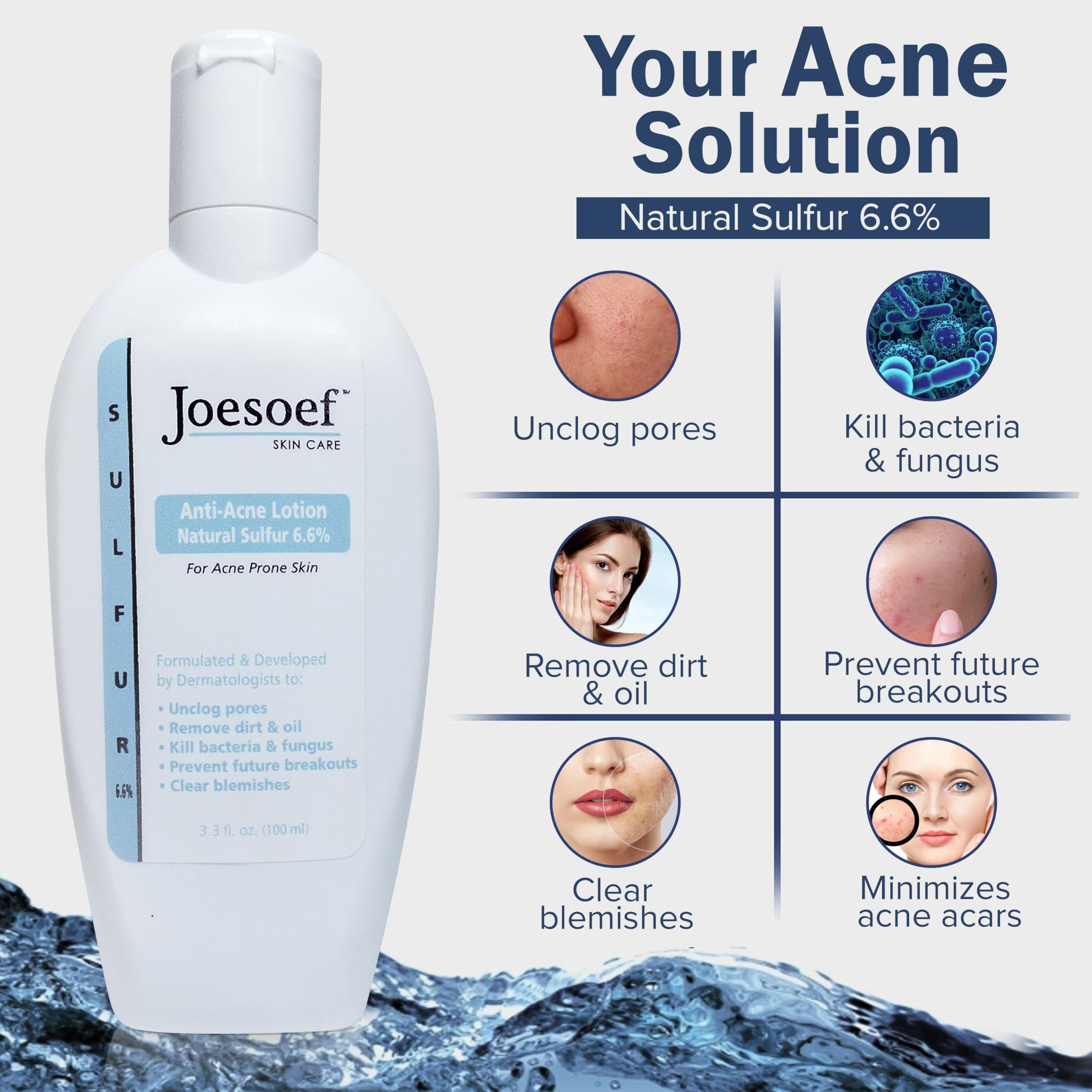 JOESOEF SKIN CARE Anti-Acne Lotion 6.6% Sulfur – Dermatologist-Approved Acne Care for Prone Skin | 100ML