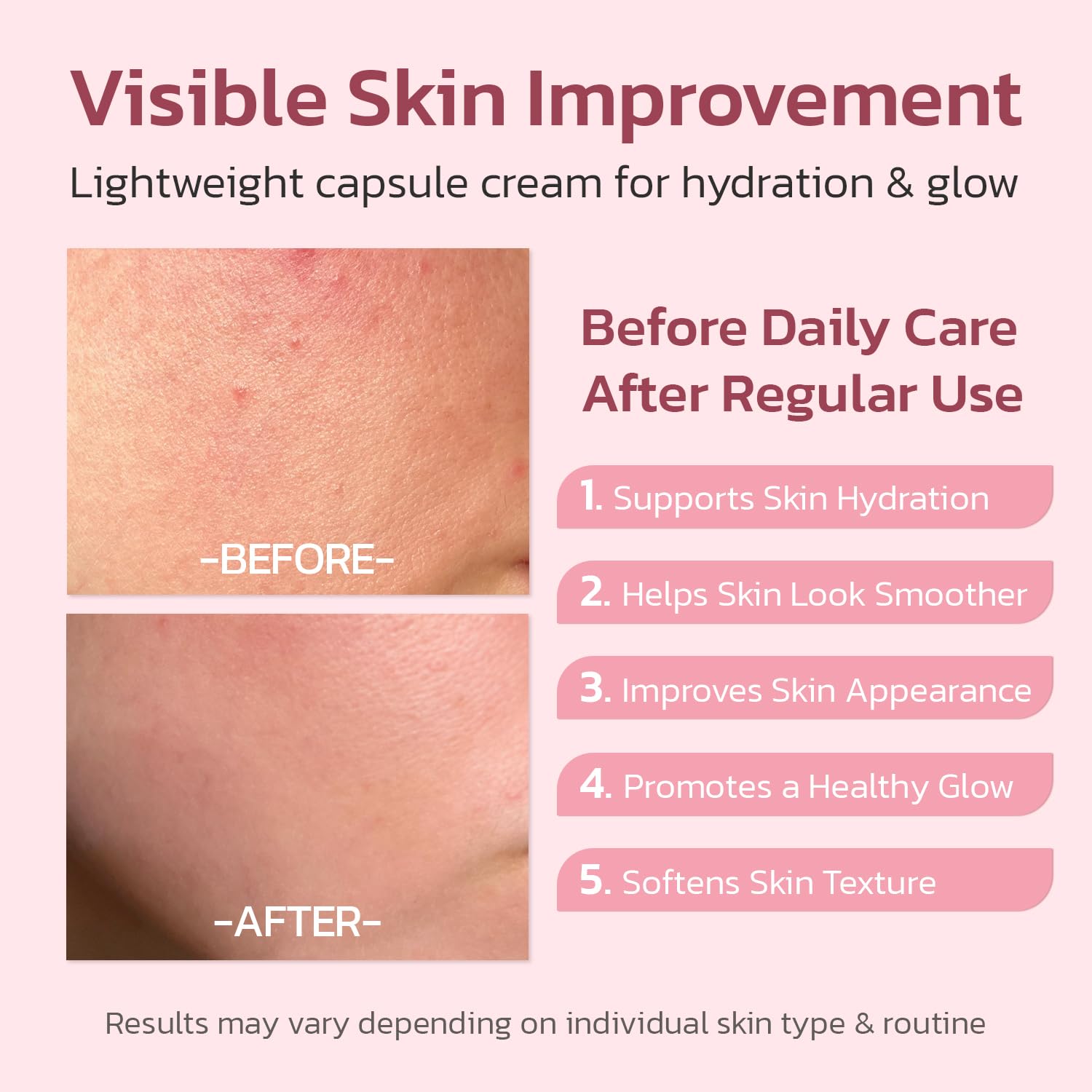 Jorceray PDRN Pink Collagen Capsule Cream – Dual-Texture Barrier Repair Moisturizer with Salmon DNA & 5% Niacinamide | 2oz