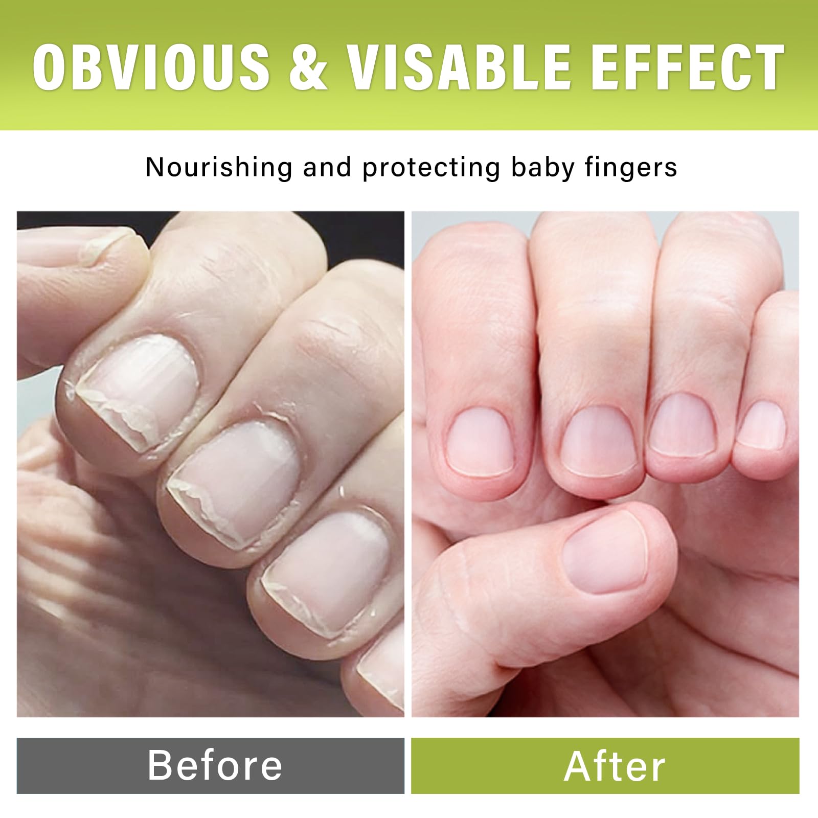 Josera Nail Biting Treatment for Kids – Safe, Natural No-Bite Cream