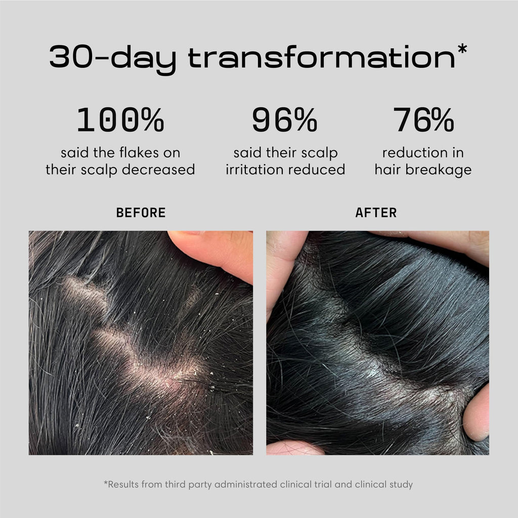 Jupiter Restoring Scalp Serum – Lightweight, Soothing Anti-Dandruff Serum for All Hair Types
