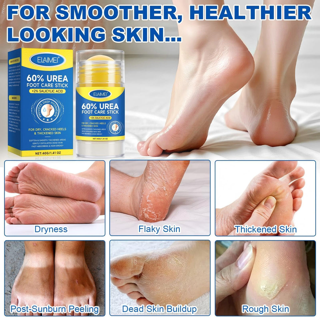 JWBVCTCR Urea Foot Cream Stick 60% Urea + 2% Salicylic Acid – Deep Hydration, Fast Absorption