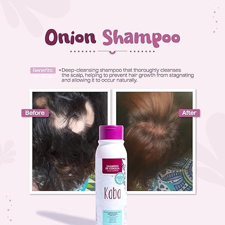 Kaba Onion Shampoo for Hair Growth – Sulfate-Free, Deep Scalp Cleansing (500 ML)