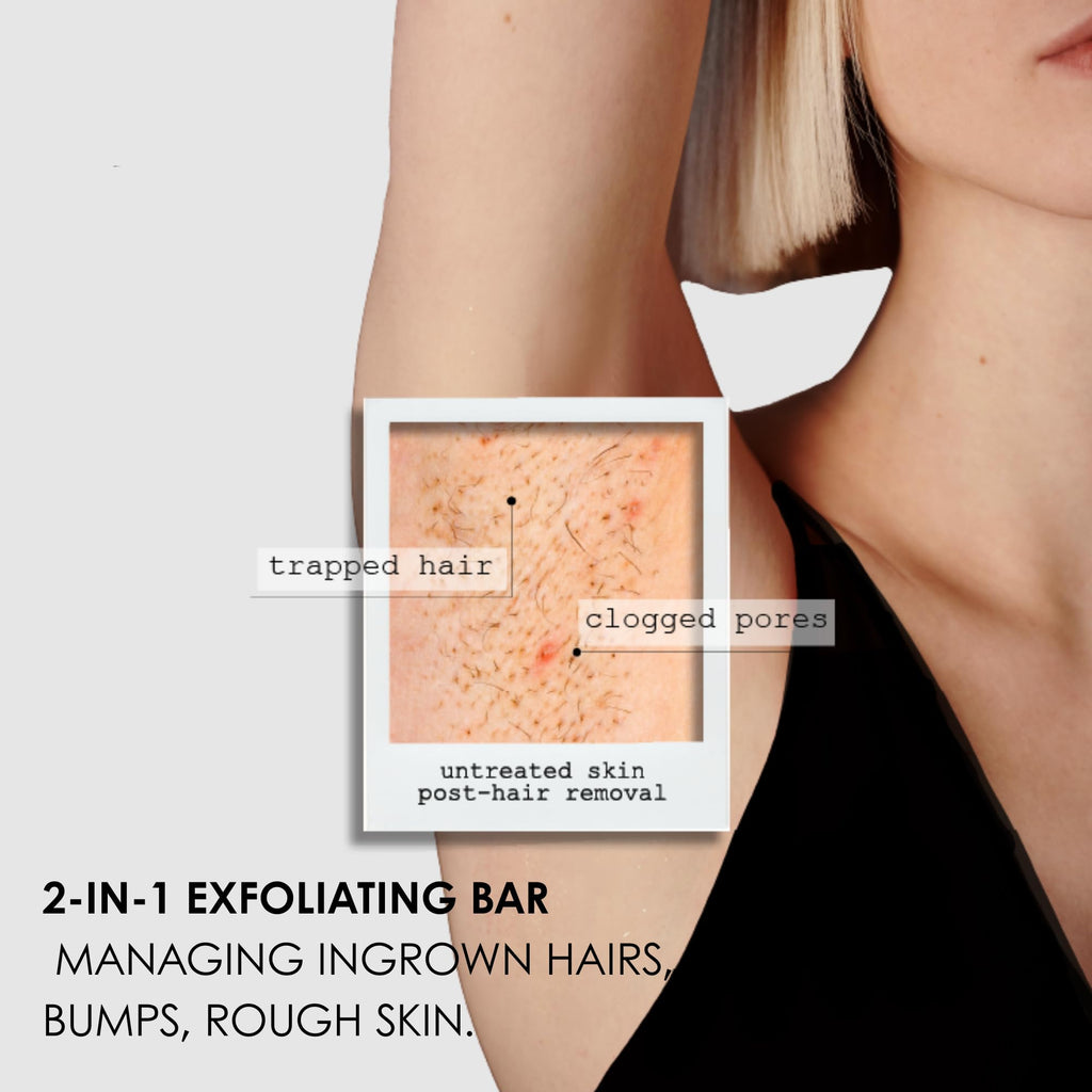 Kaia Naturals Takesumi Bright Ingrown Bar – Exfoliating Soap for Ingrown Hairs & Razor Bumps, 2.4oz