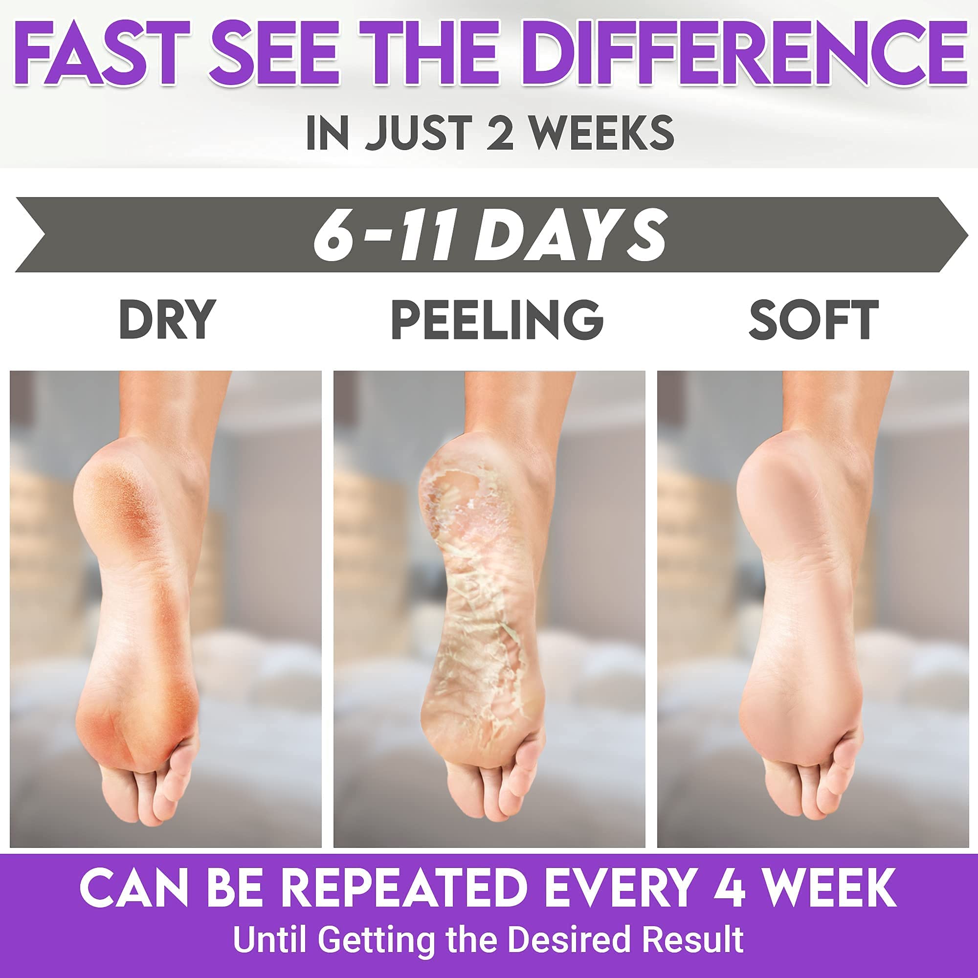 Karma Organic Foot Peel Mask Lavender – Moisturizing Exfoliating Foot Masks (Pack of 2)