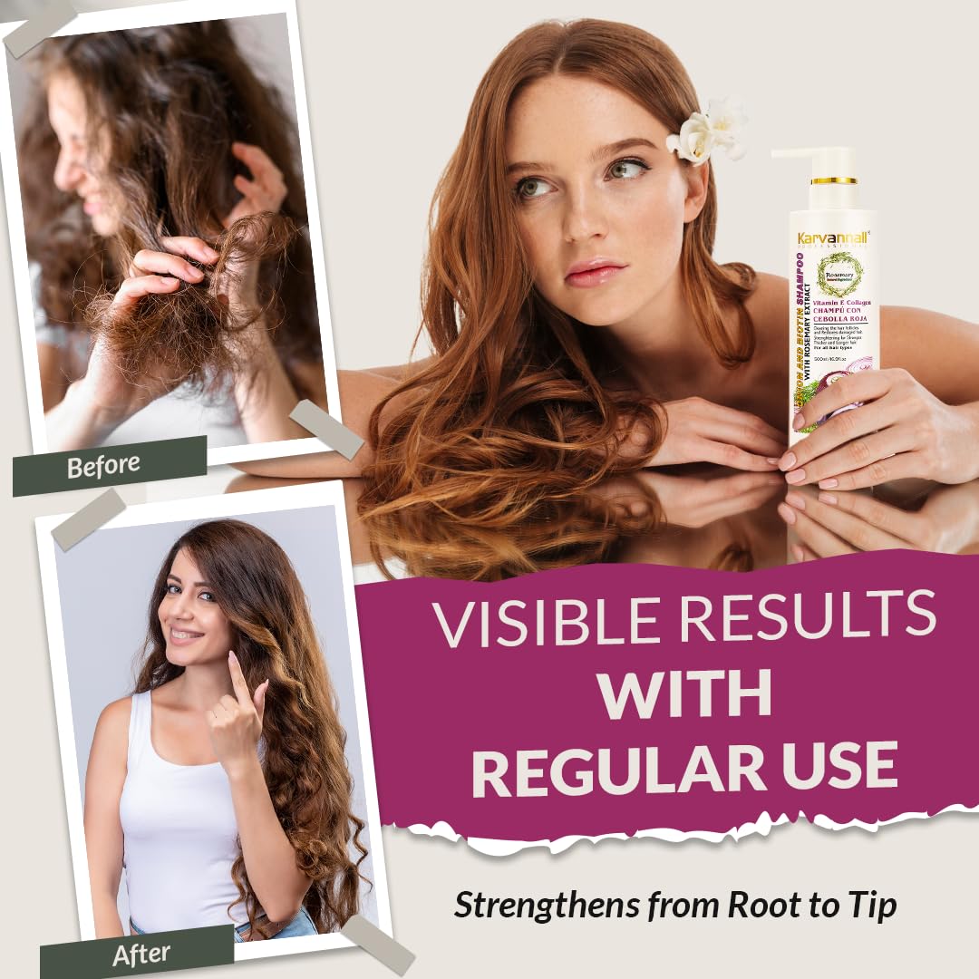 Karvannall Rosemary Biotin Shampoo & Hair Mask Set – Anti-Thinning, Onion Extract, Collagen & Vitamin E