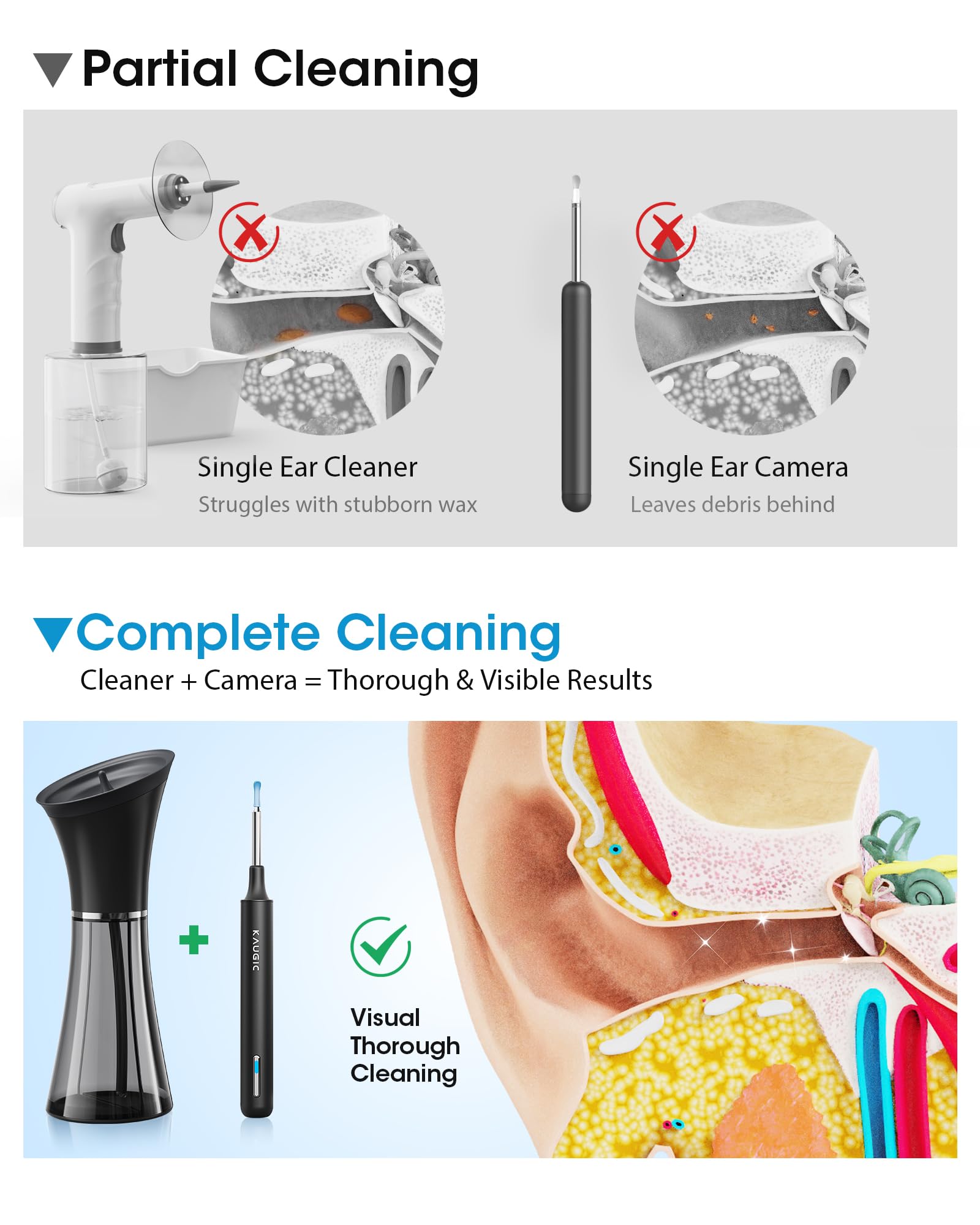 KAUGIC Ear Wax Removal Kit with Camera – Safe, Visual Ear Cleaning