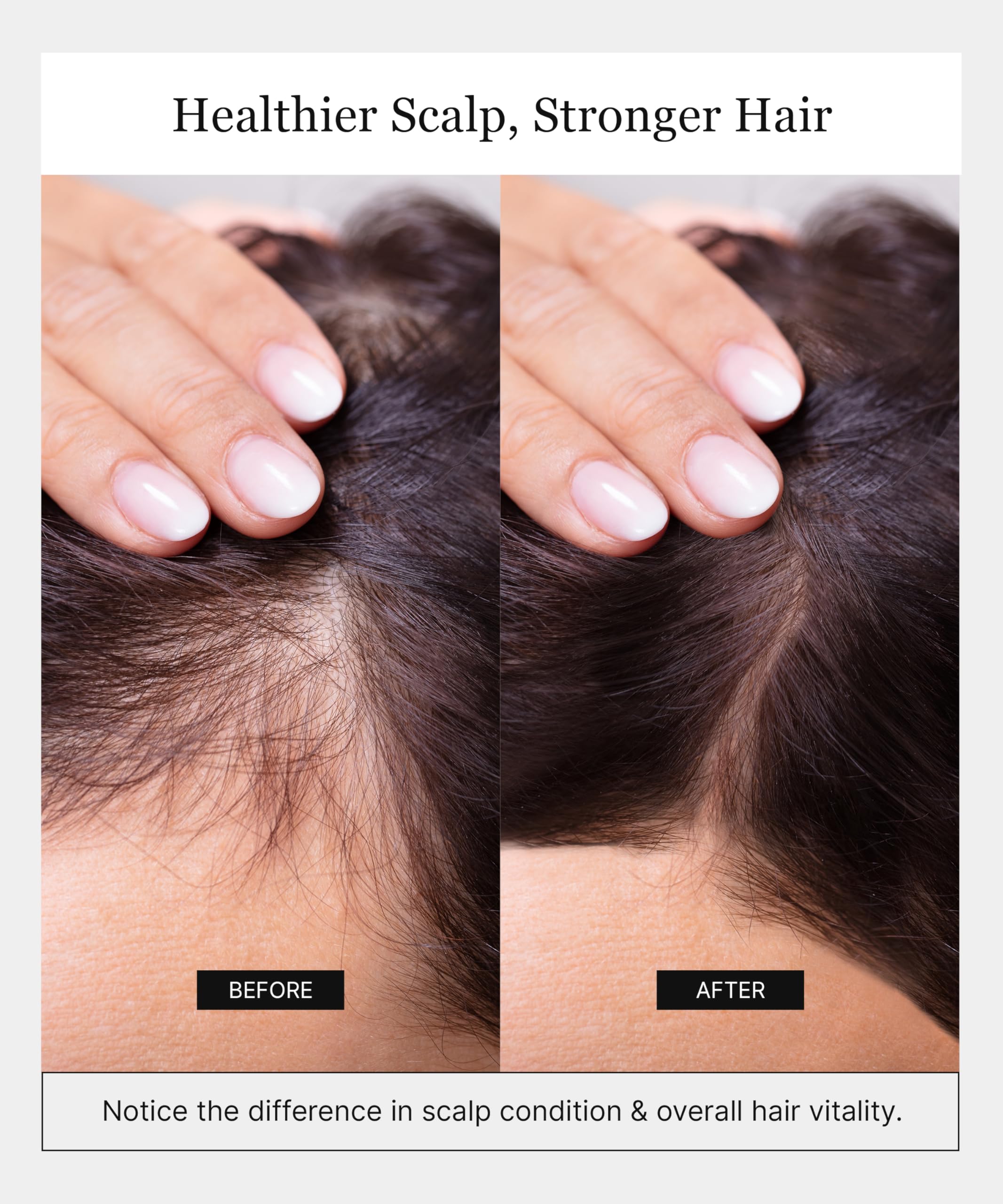 Keracell Invigorating Shampoo – Hair Growth & Scalp Support with Human Stem Cell Extract, Cleanse, Strengthen & Hydrate (8 oz)