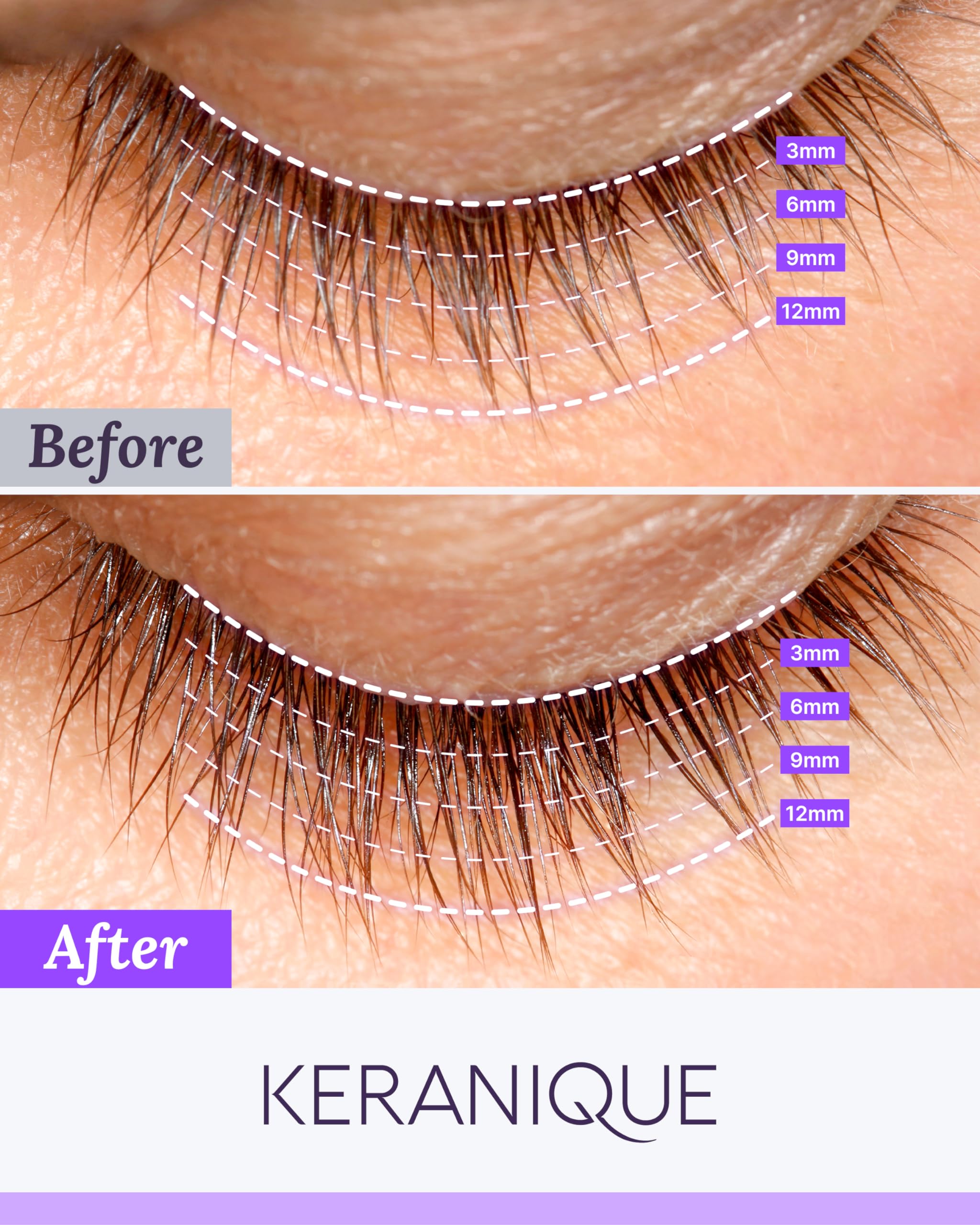 Keranique Lash Growth Serum – Intense Eyelash Enhancer for Thin & Brittle Lashes