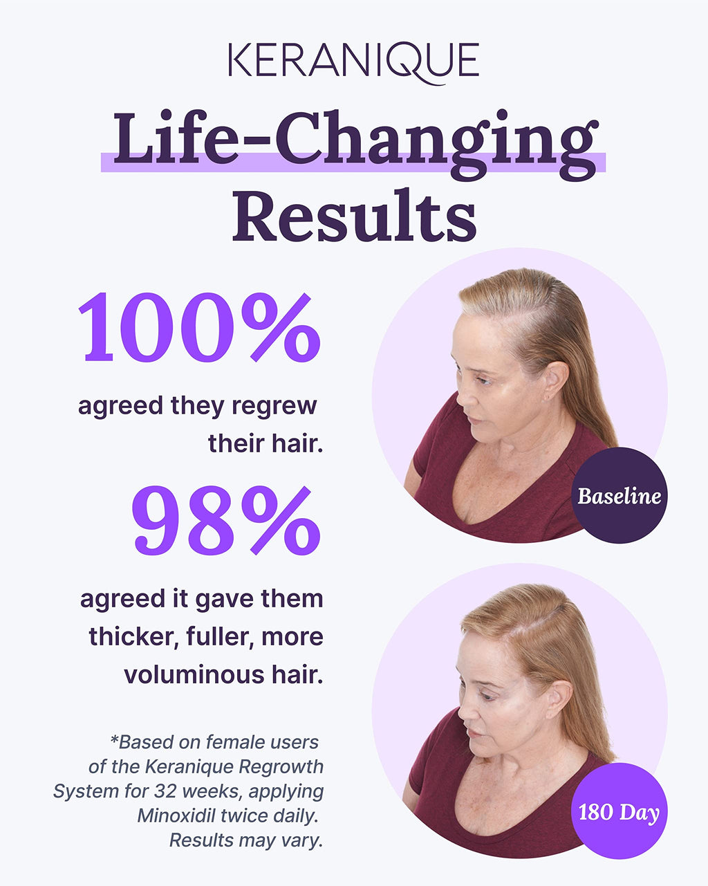 Keranique Hair Regrowth Treatment for Women – 2% Minoxidil with Precision Spray