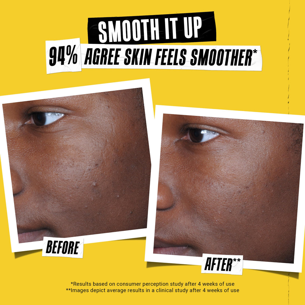 Kiehl's Better Screen UV Serum SPF 50+ | Invisible Facial Sunscreen with Collagen Peptide