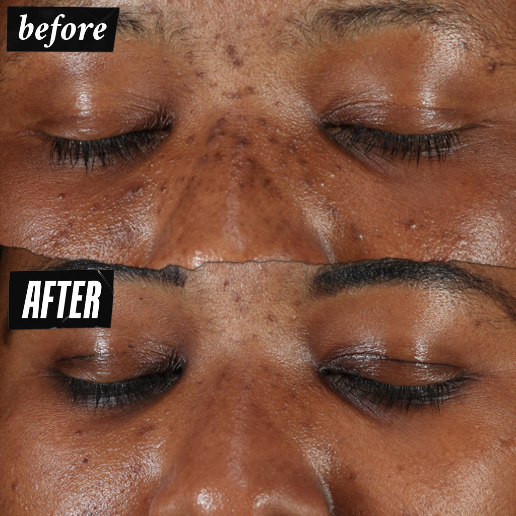 Kiehl's Clearly Corrective Dark Spot Serum | Brightening Facial Serum for Even Skin Tone