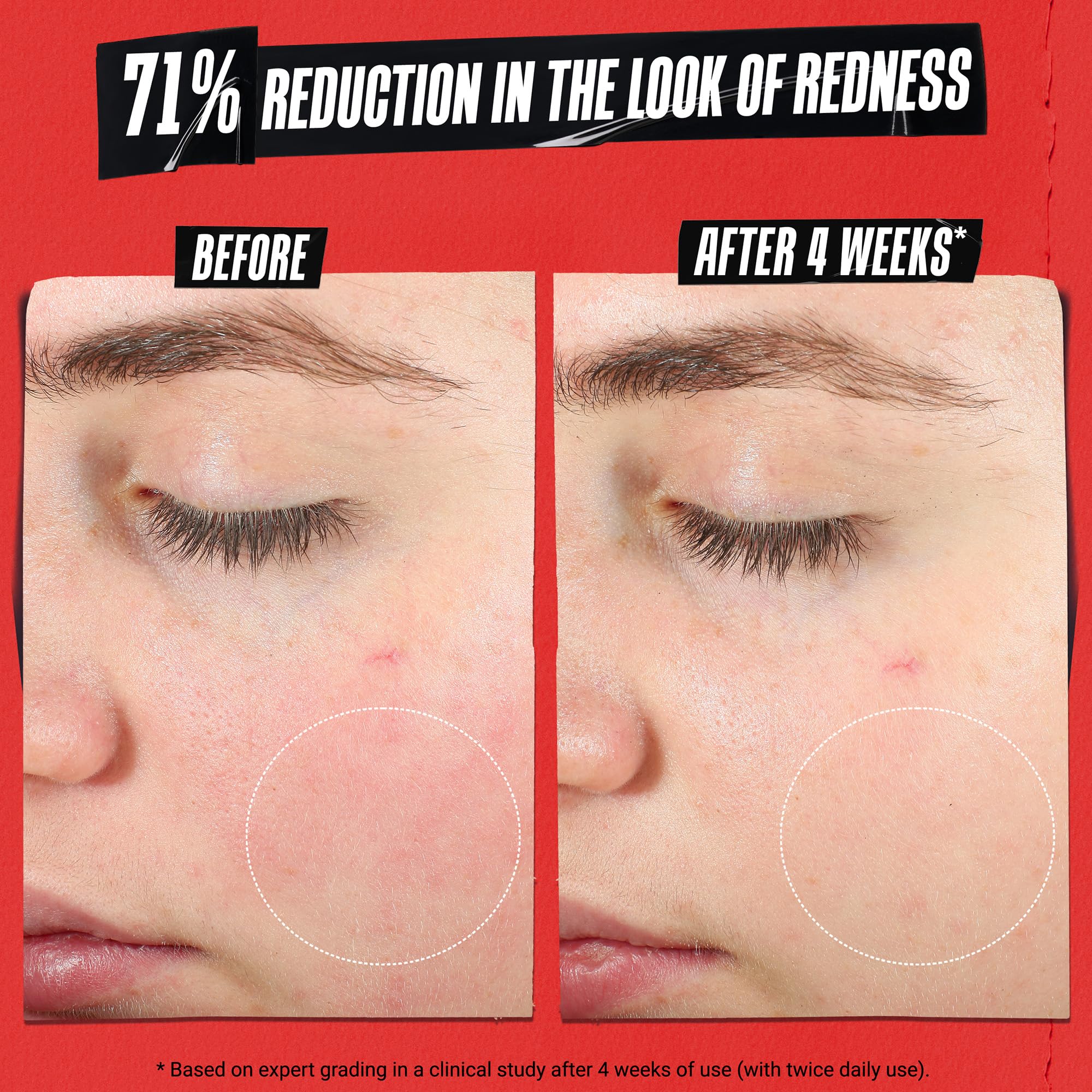 Kiehl's Ultra Facial Recovery Barrier Cream – Lightweight Moisturizing for Dry & Sensitive Skin