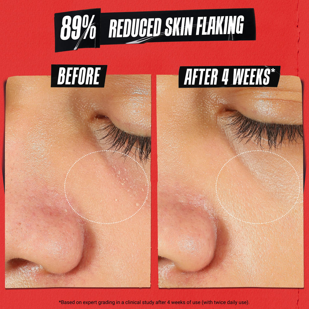 Kiehl's Ultra Facial Recovery Barrier Cream – Lightweight Moisturizing for Dry & Sensitive Skin