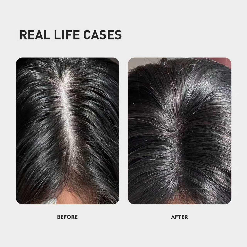 KINTOR 0.9% KX-826 DHT Blocker for Men & Women – Hair Growth Spray 60ml Pro