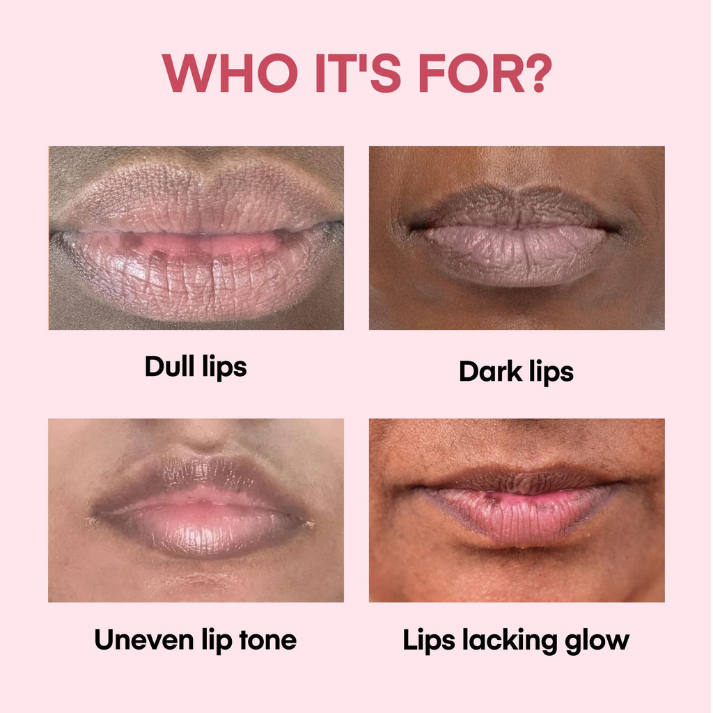 KissBea Lip Lightening for Dark Lips – Hydration & Tone with Vitamin C, Lemon Peel & Licorice | 15 mL
