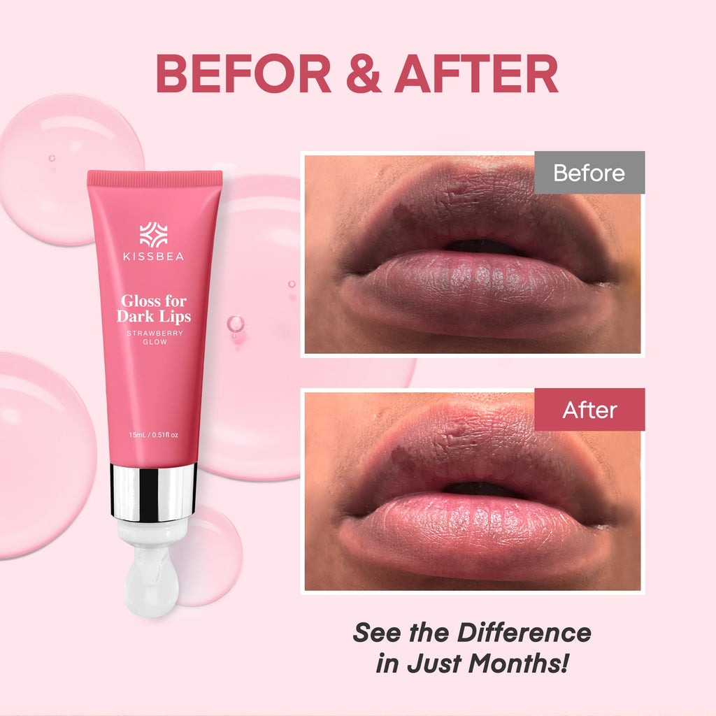 KissBea Lip Lightening for Dark Lips – Hydration & Tone with Vitamin C, Lemon Peel & Licorice | 15 mL