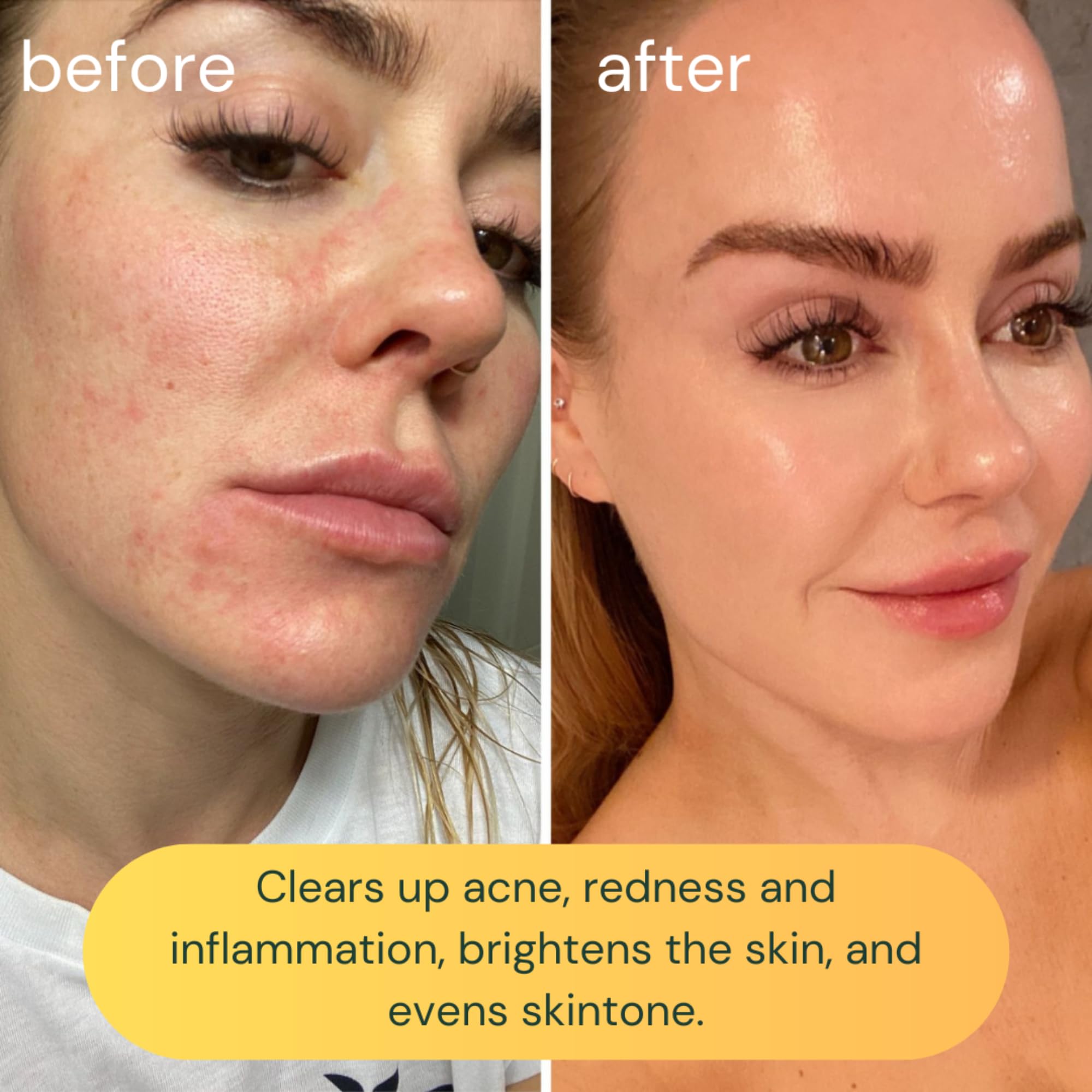 KOA LIFE Vit-C Illuminating Facial Cleanser – Vitamin C Brightening Wash, Vegan & Cruelty-Free