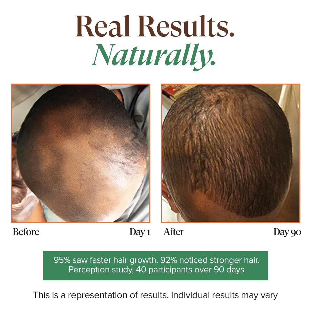 KREYÒL ESSENCE Haitian Black Castor Oil for Skin & Hair – Cold Pressed, Hexane Free, Mango Papaya & Coconut, 3.4 fl oz