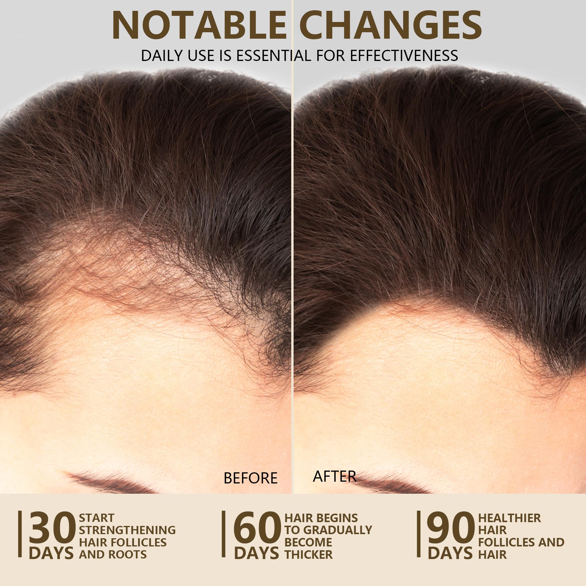 Ktintar 100% Natural Raw Batana Oil for Hair Growth – Unrefined Honduran Hair Oil (5.07 Fl Oz)