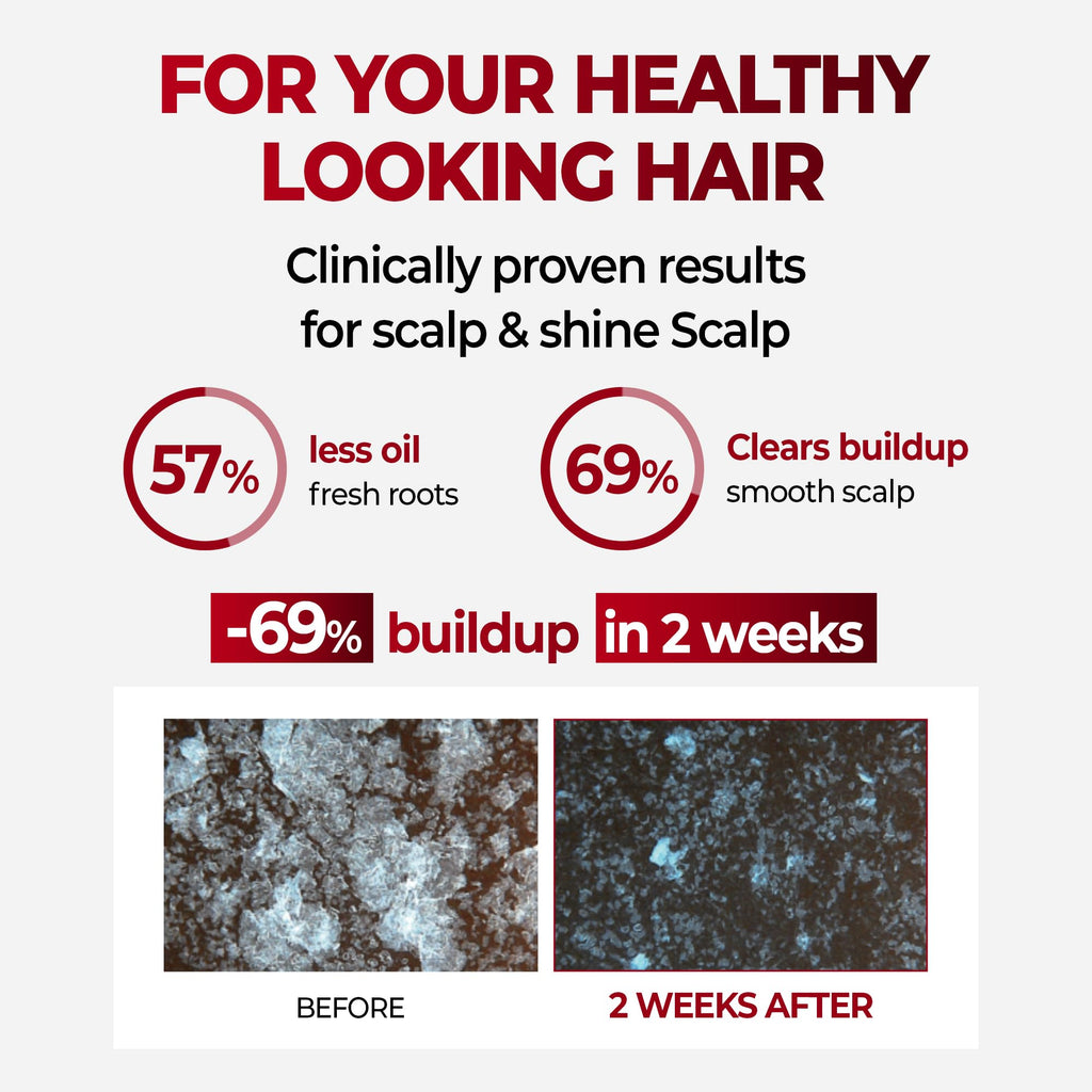 KUNDAL Korean Caffeine Scalp Shampoo Cherry Blossom – Sulfate-Free with Menthol, 16.9 Fl Oz – Stocking Stuffers