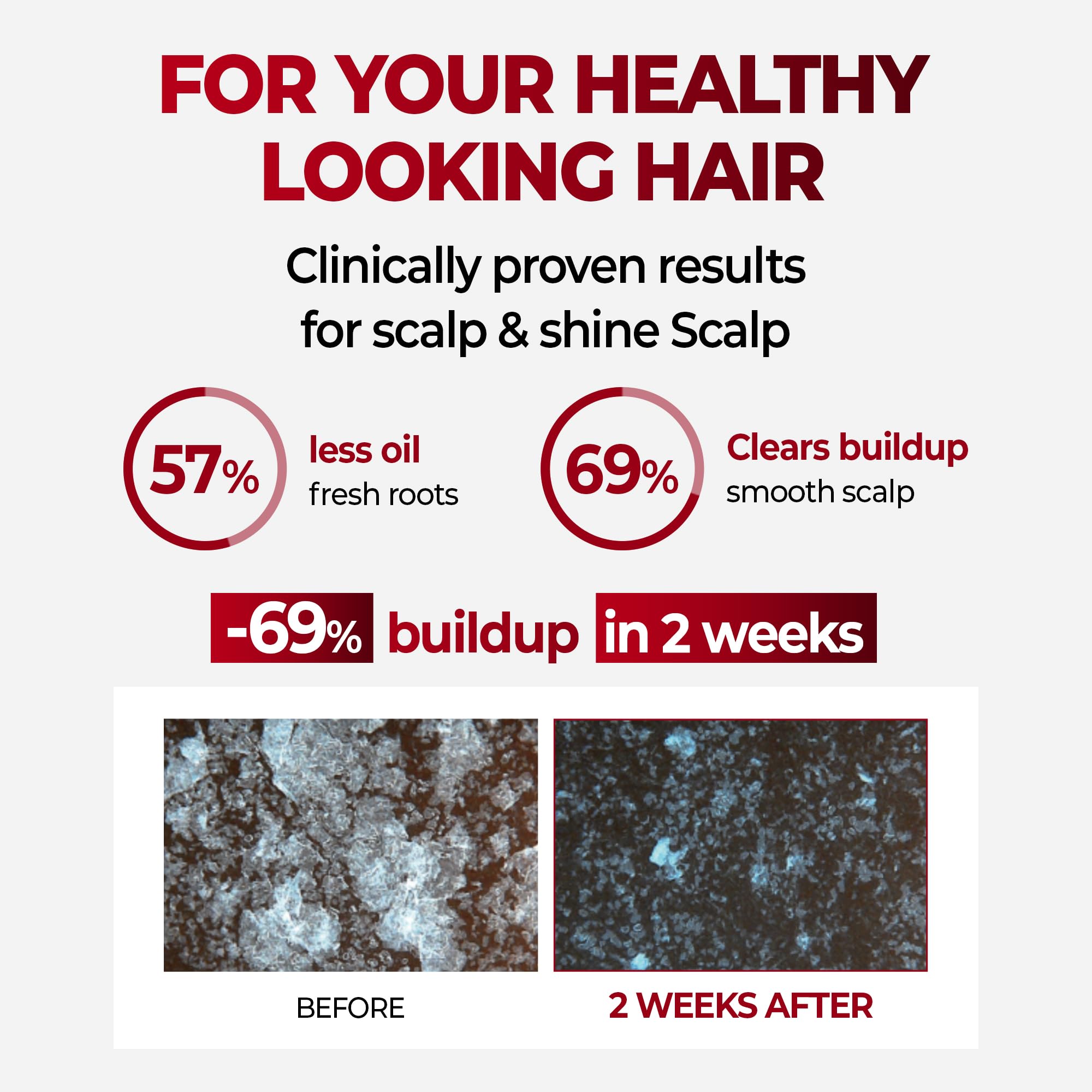 KUNDAL Korean Caffeine Scalp Shampoo Cherry Blossom – Sulfate-Free with Menthol, 16.9 Fl Oz – Stocking Stuffers
