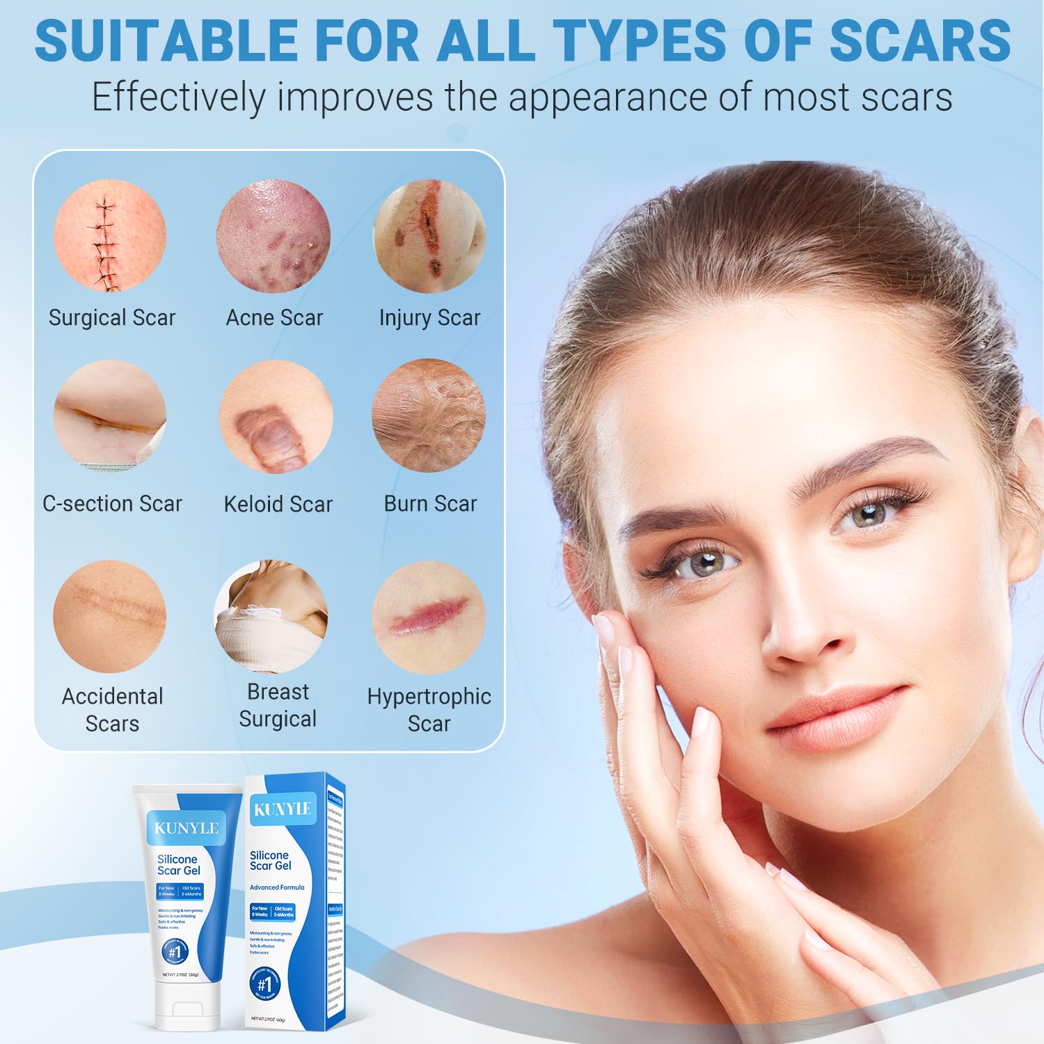 Kunyle Silicone Scar Gel – Advanced Scar Cream for Surgical Scars, Stretch Marks & Keloids | 2.11oz