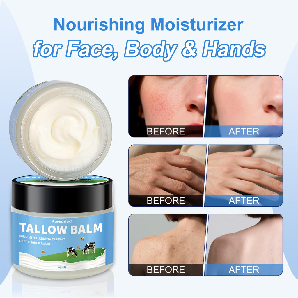 Kweqdsd 5 Pack Organic Grass-Fed Beef Tallow Balm with Raw Honey | Natural Skin Moisturizer