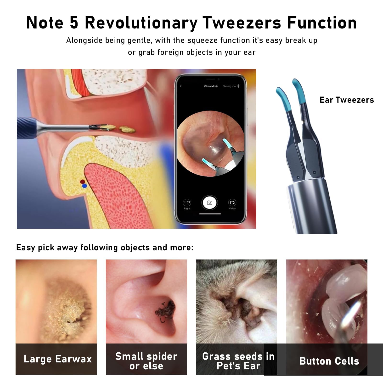 KWYBOW Note5 Ear Wax Removal Kit with Camera – 10MP Otoscope & Real-Time Video