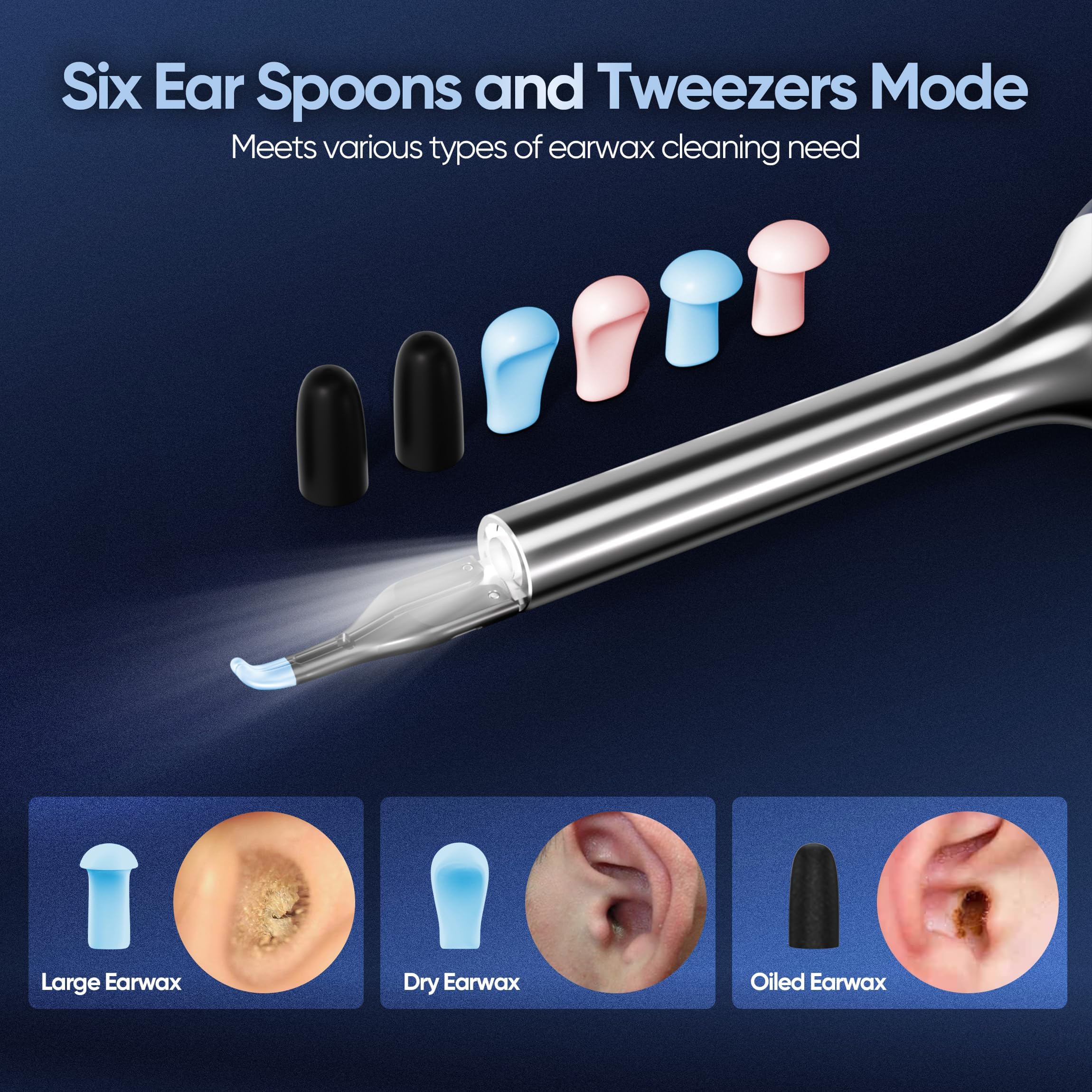 KWYBOW Note5 Ear Wax Removal Kit with Camera – 10MP Otoscope & Real-Time Video