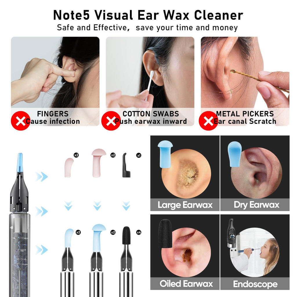 KWYBOW Note5 Ear Wax Removal Kit with Camera – 10MP Otoscope & Real-Time Video