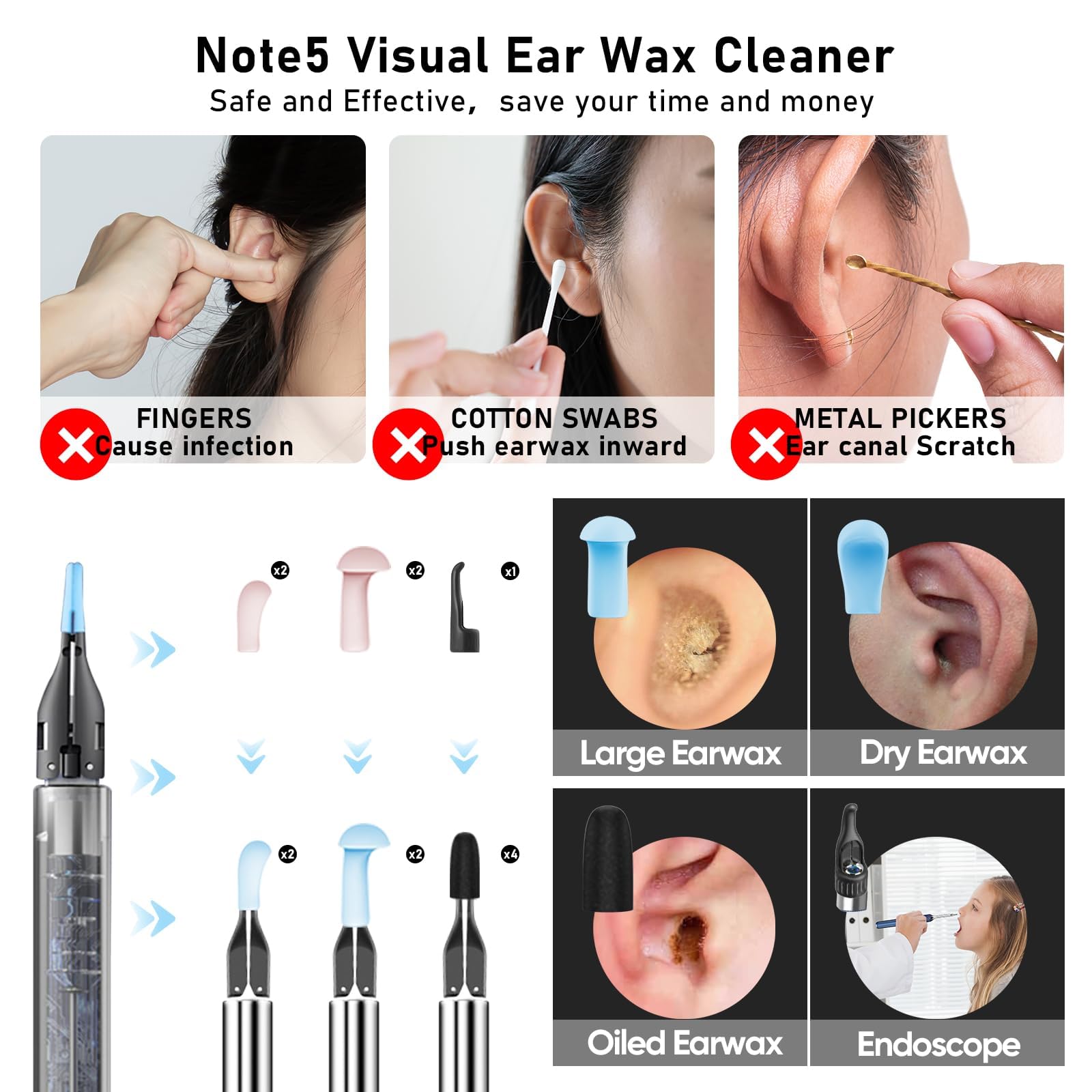 KWYBOW Note5 Ear Wax Removal Kit with Camera – 10MP Otoscope & Real-Time Video