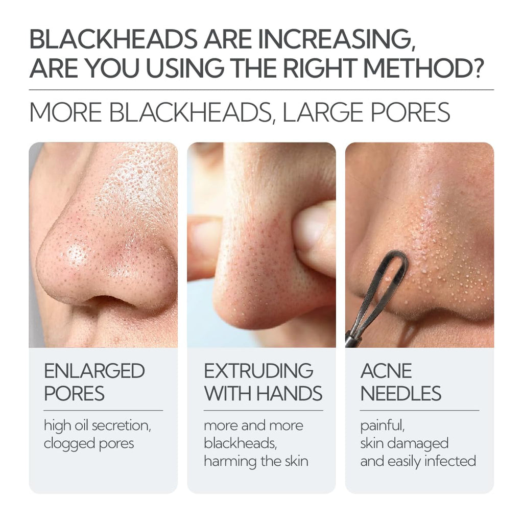 LANBENA 3 in 1 Blackhead Removal Set — Pore Strips, Serum & Removal Papers