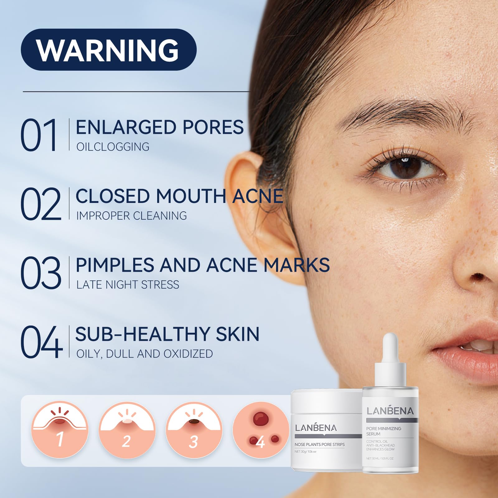 LANBENA 3 in 1 Blackhead Removal Set — Pore Strips, Serum & Removal Papers