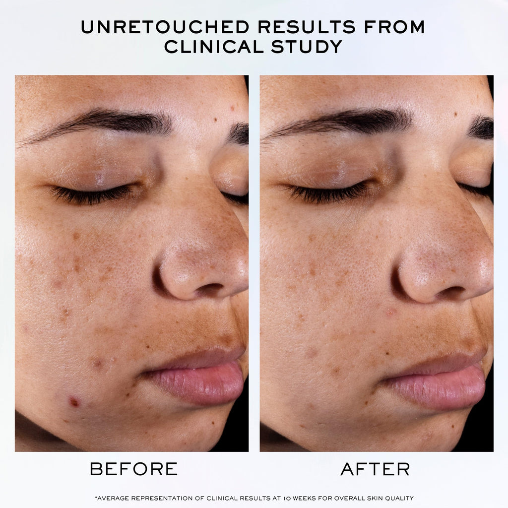 Lancôme Clarifique Pro-Solution Serum – Brighten Dark Spots & Refine Pores | 10% PHA + Niacinamide