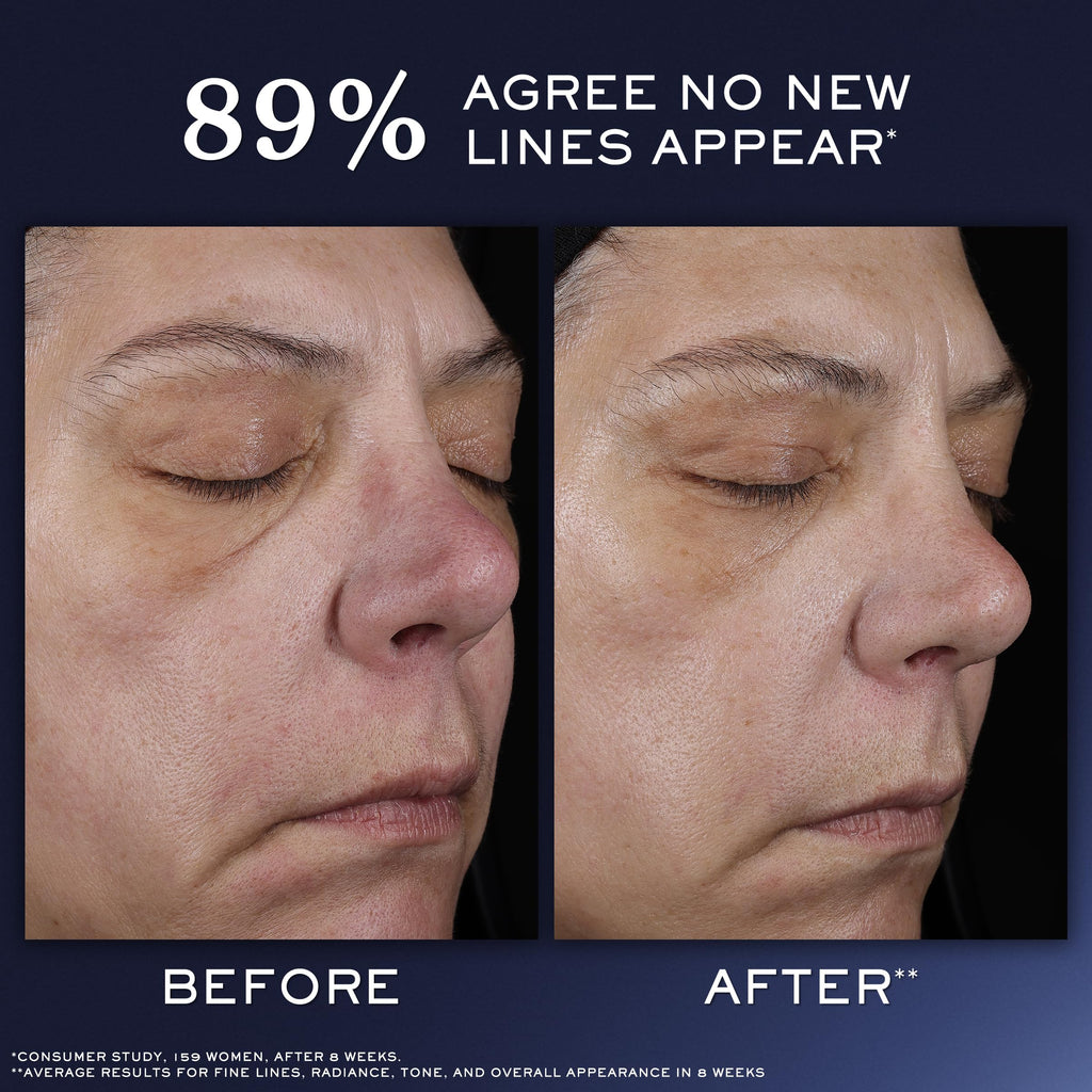 Lancôme Génifique Ultimate Recovery Serum – Anti-Aging, Hydration & Radiance