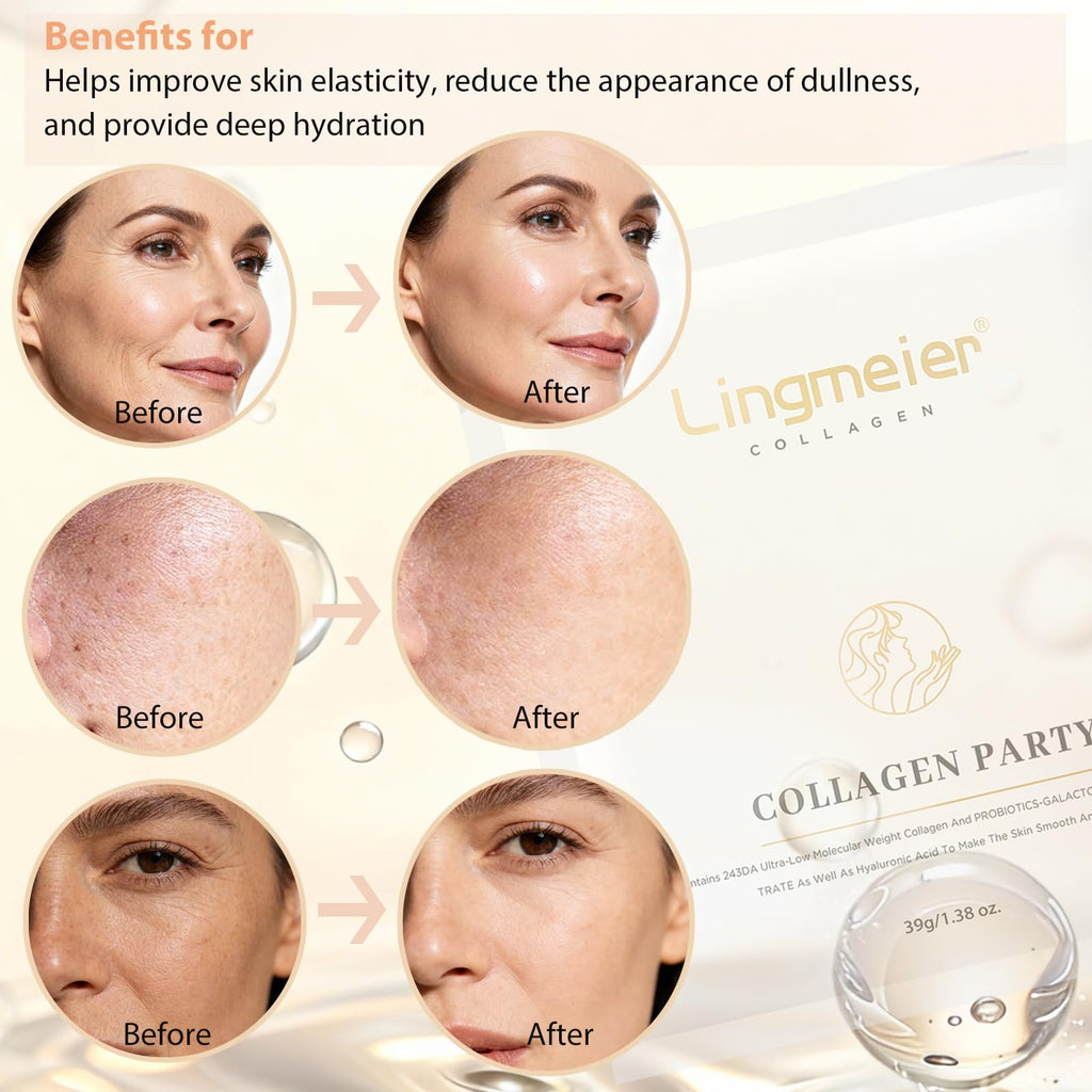 Lingmeier Hydrating Overnight Collagen Mask – 4 Sheets for Deep Moisture & Elasticity