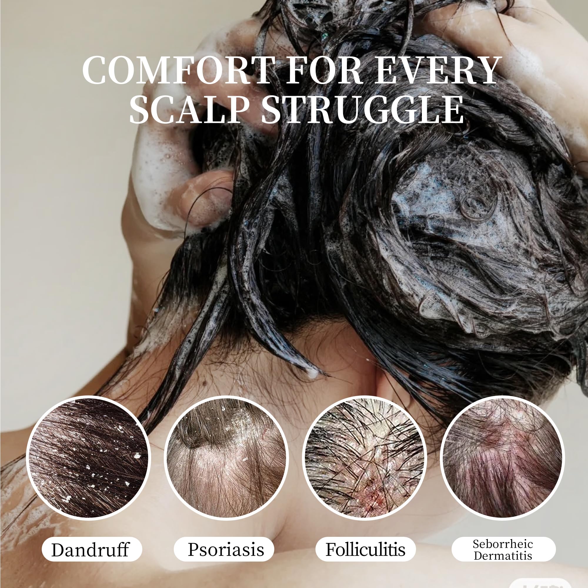 Listarfe Dandruff Shampoo – Anti-Fungal Scalp Care for Dandruff, Psoriasis & Dermatitis 300ML