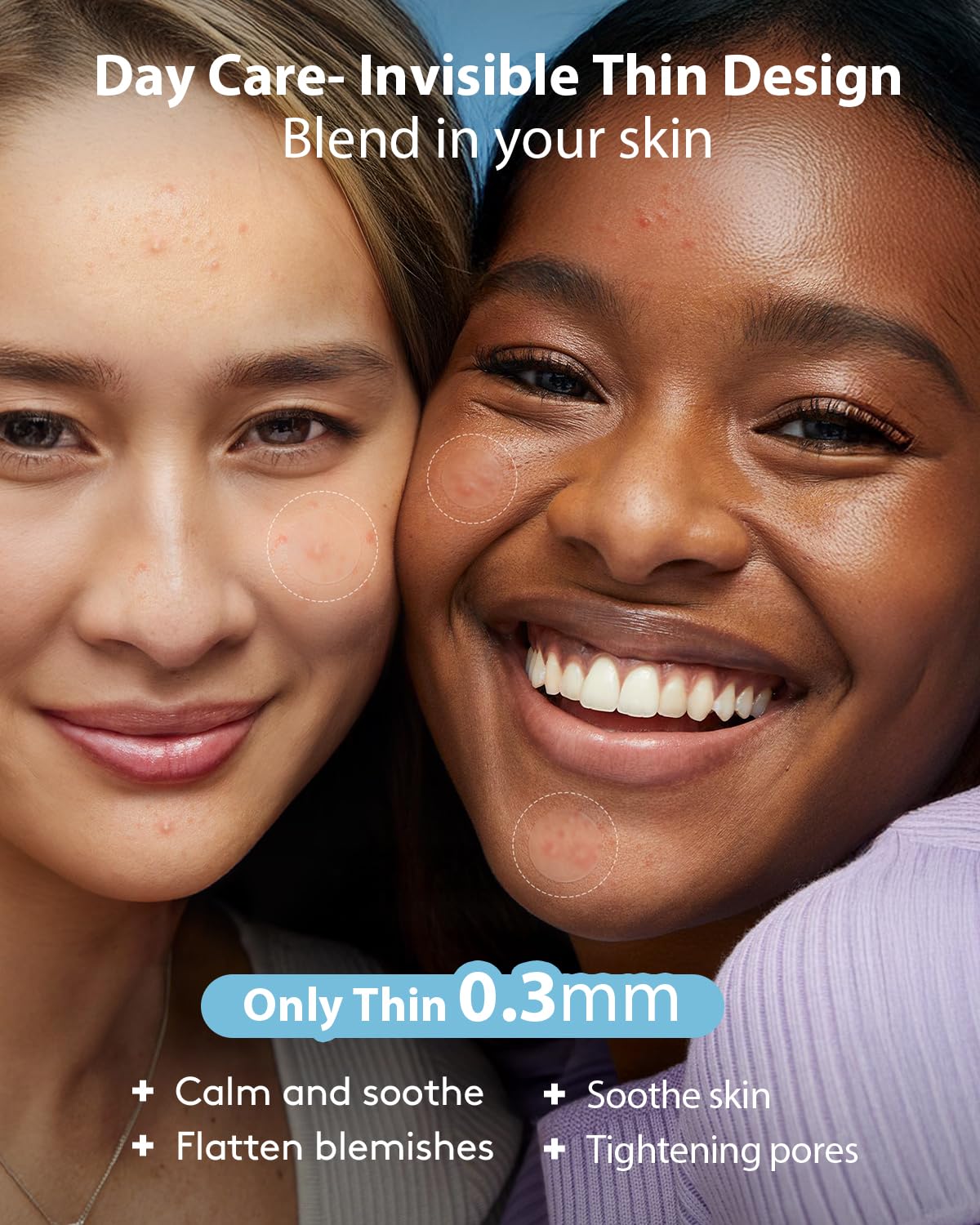 LitBear Acne Pimple Patches – Day & Night, 4 Sizes, 588 Dots