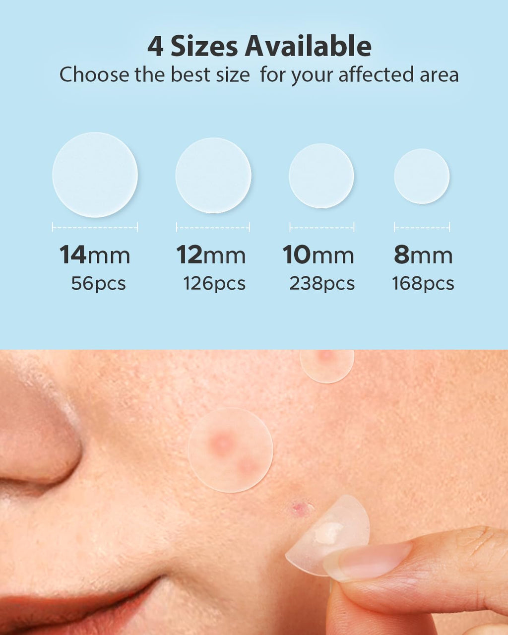 LitBear Acne Pimple Patches – Day & Night, 4 Sizes, 588 Dots