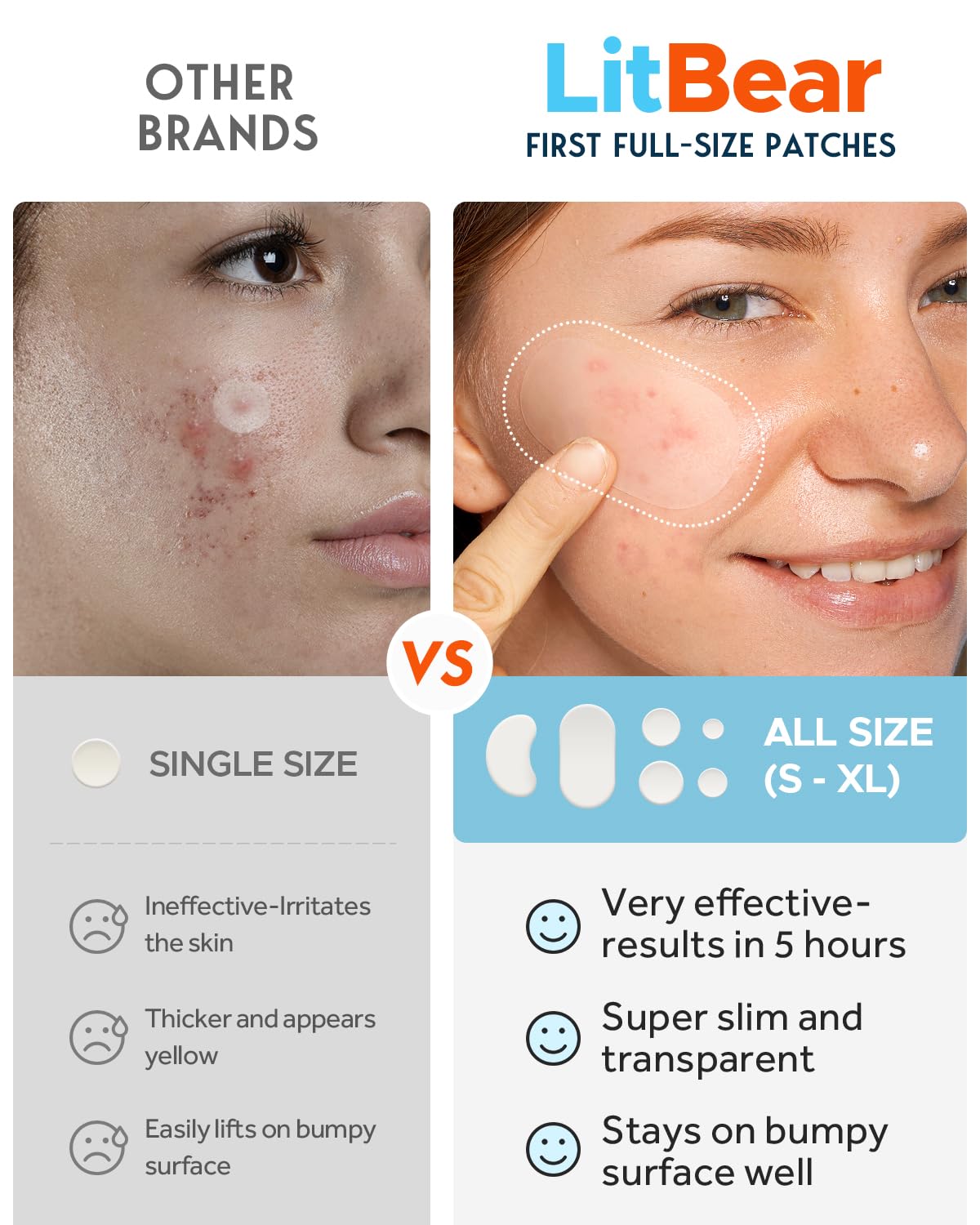 LitBear Large Acne Pimple Patches – 100 Patches, 6 Sizes, Tea Tree & Calendula, Hydrocolloid for Face & Body