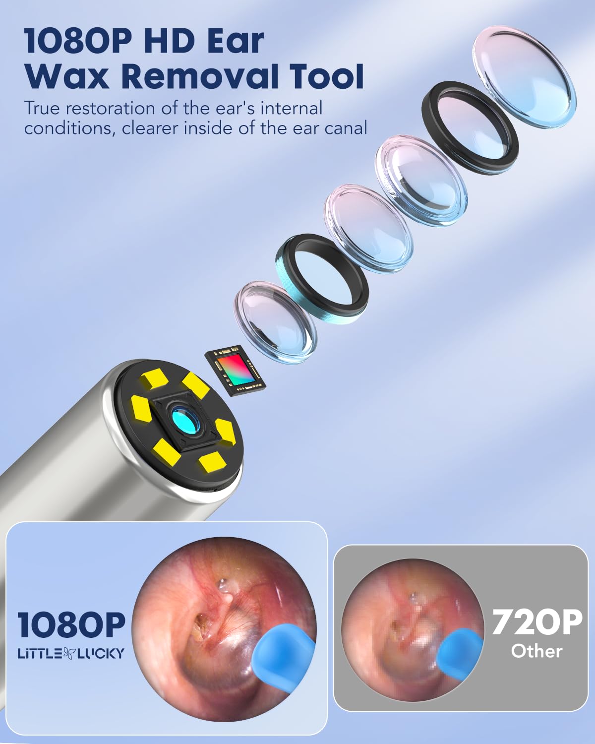 Littlelucky 4-in-1 Ear Canal Cleaner with 1080P HD Lens, 6 LED Lights – Ear, Nose, Throat & Skin Viewing for iOS & Android