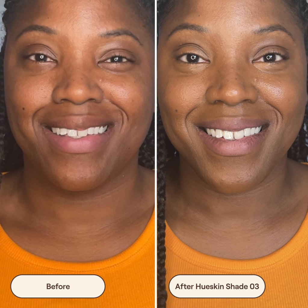 Live Tinted Hueskin Serum Concealer – Medium-to-Full Coverage with Niacinamide & Hyaluronic Acid | Shade 3